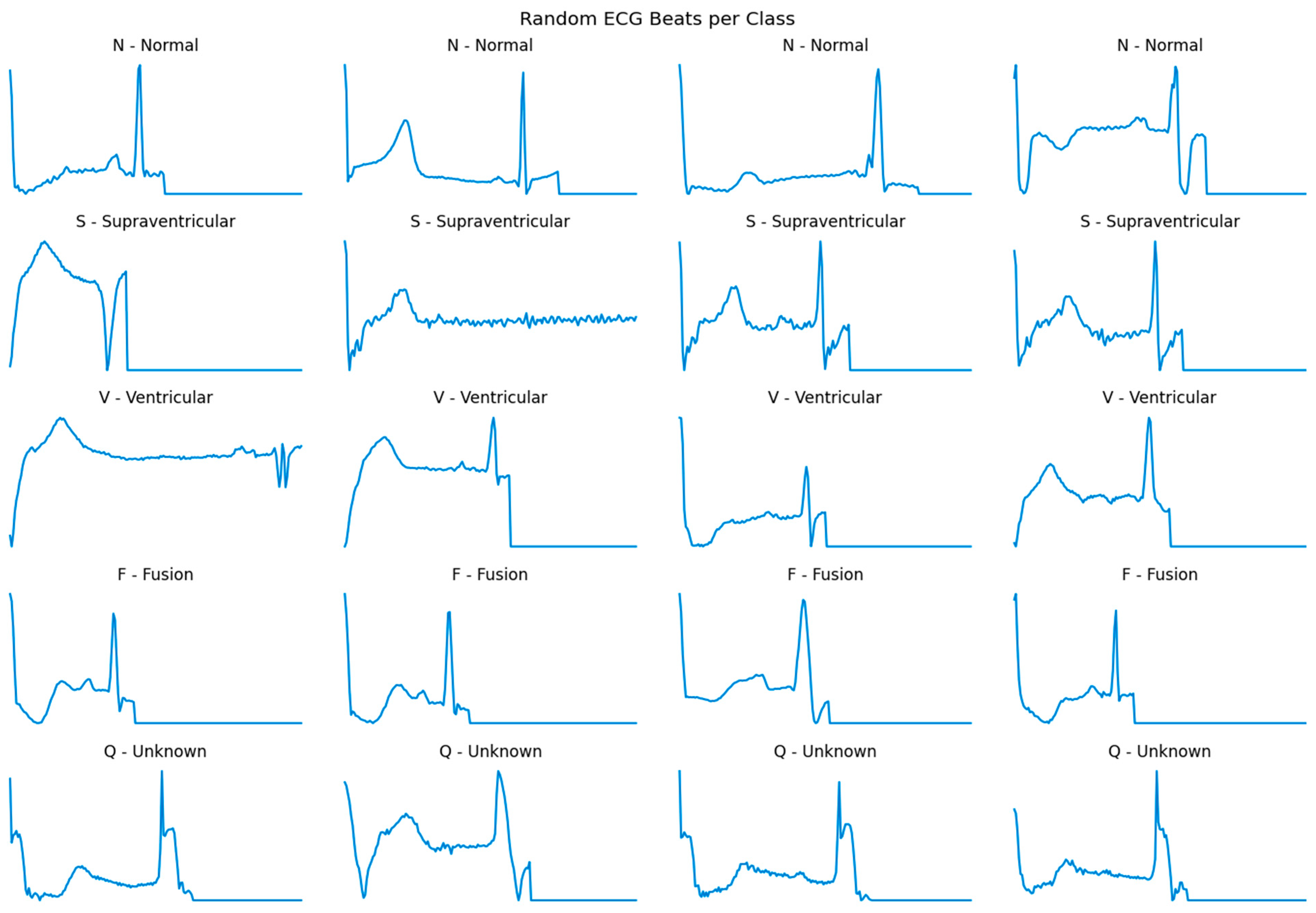 Robust and Calibrated ECG Heartbeat Classification via Hybrid ...