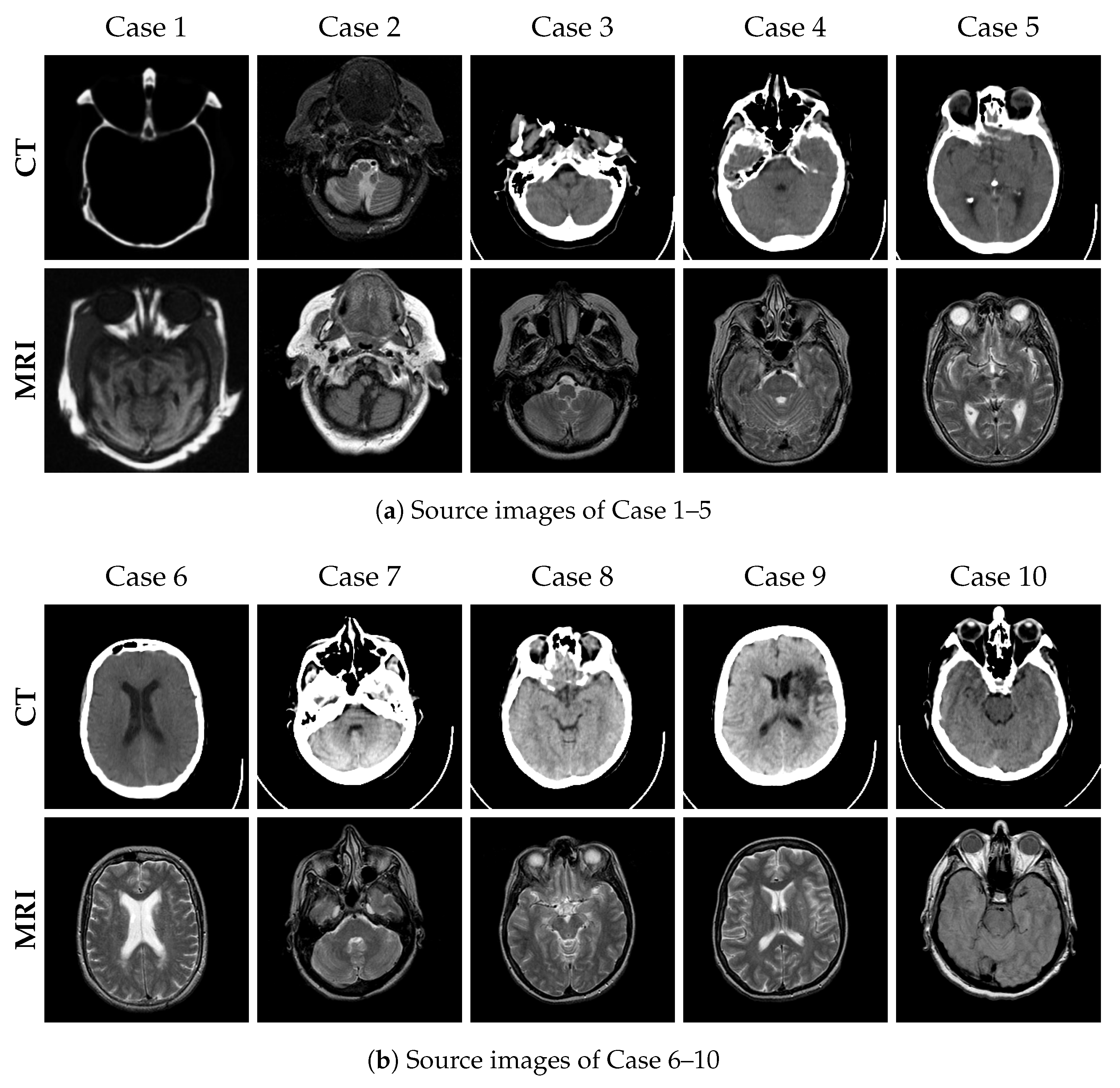 Accelerated Edge-Aware Diffusion Model with Spatial Refinement for ...