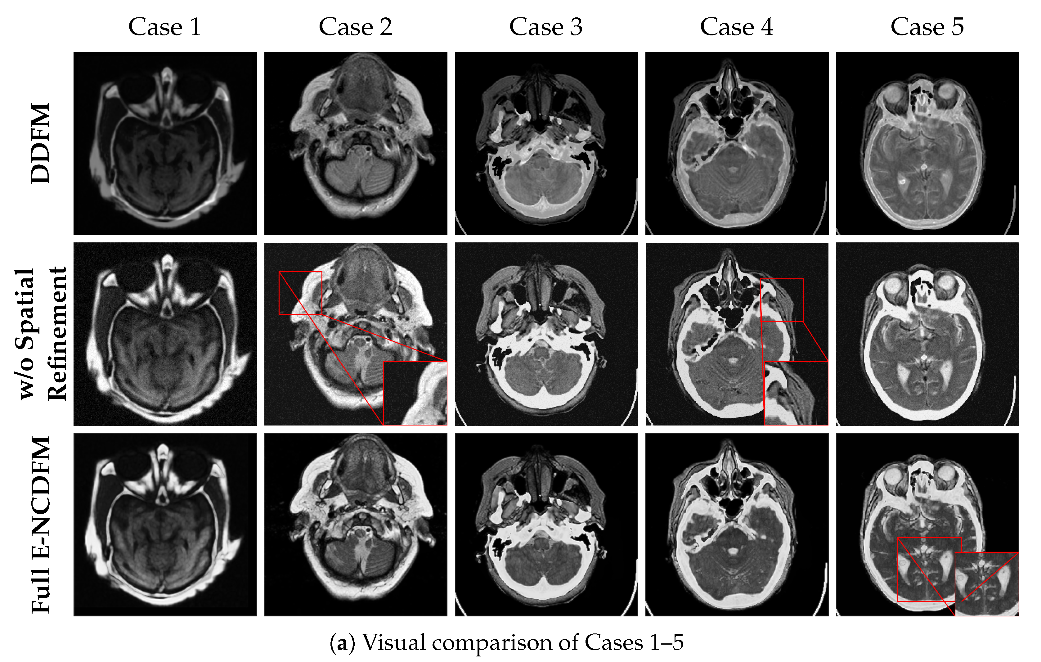 Accelerated Edge-Aware Diffusion Model with Spatial Refinement for ...