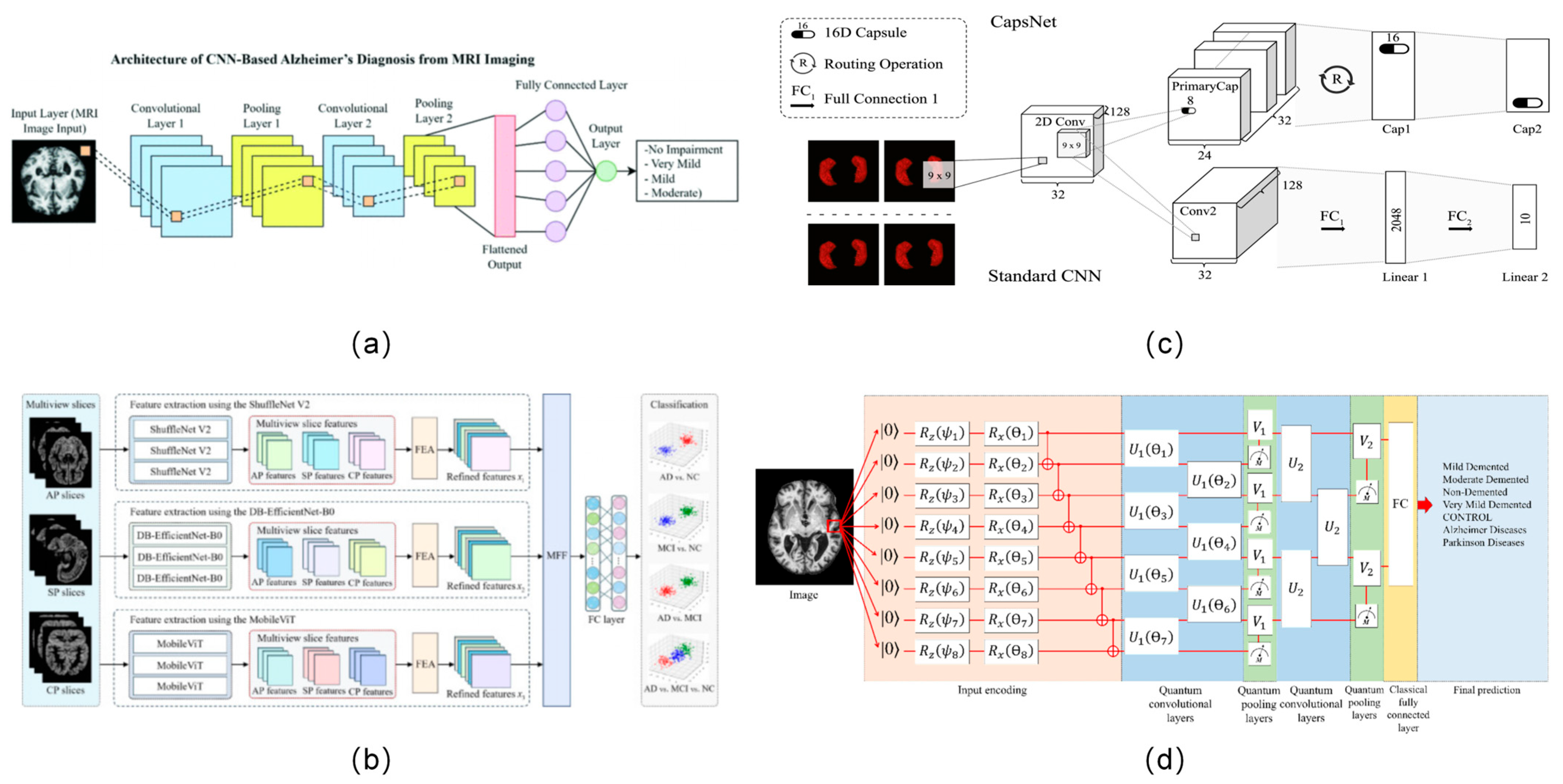 Artificial Intelligence in Alzheimer’s Disease: A Review of Early Detection