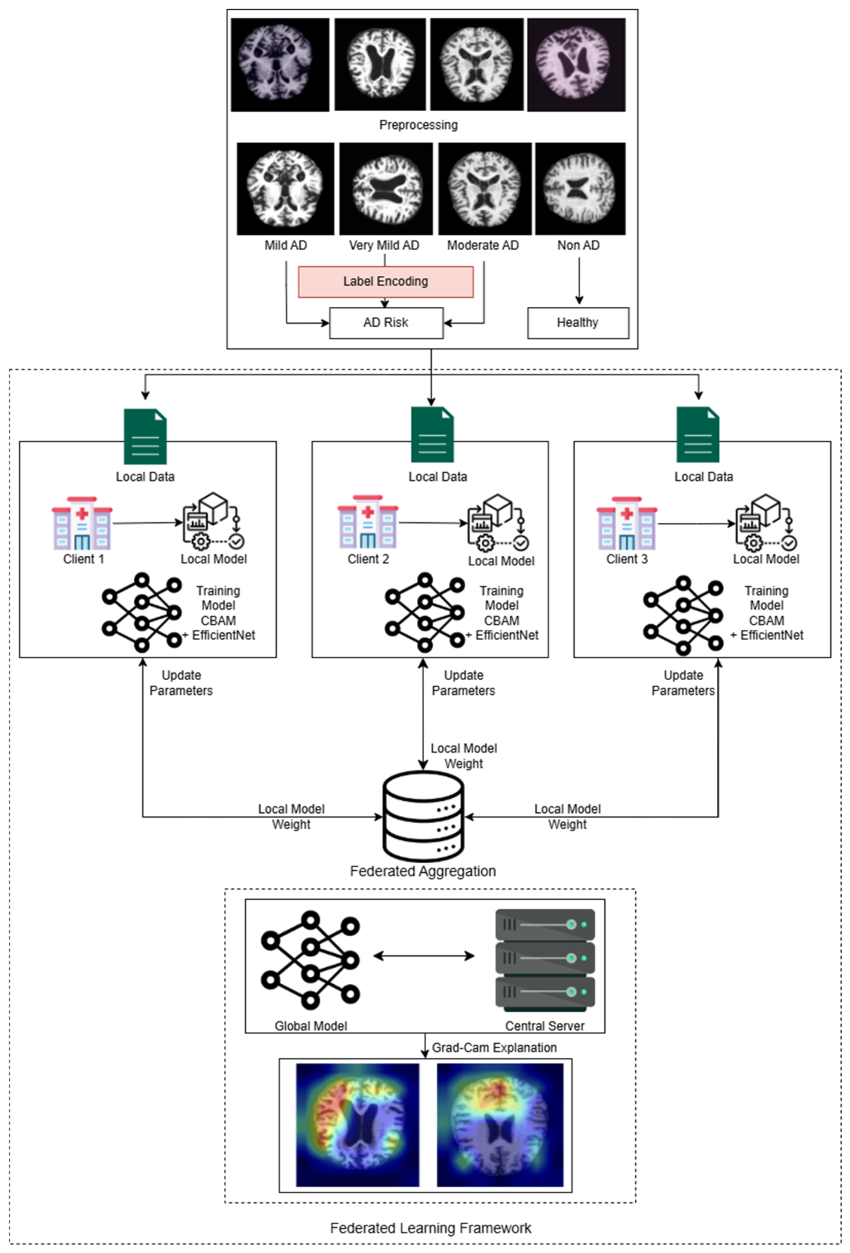 Explainable Federated Attention-Based Deep Learning for Alzheimer’s ...