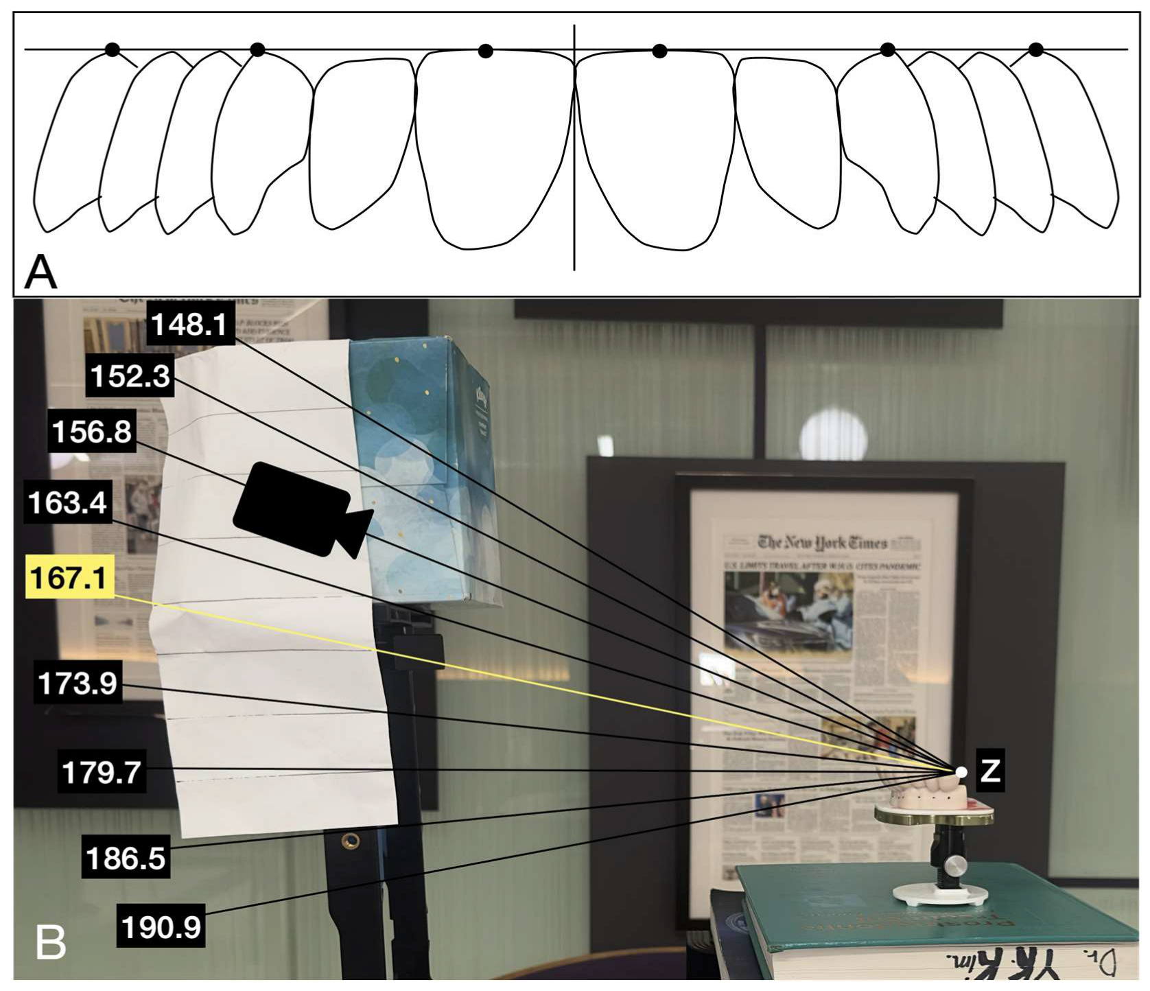 Geometric Distortion Induced by Vertical Camera Positioning in Dental ...