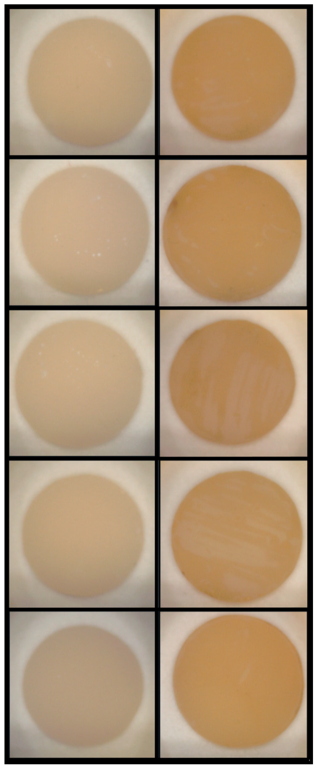 Setamine Influence of Surface Sealants and Chromogenic Dietary Agents on the ...