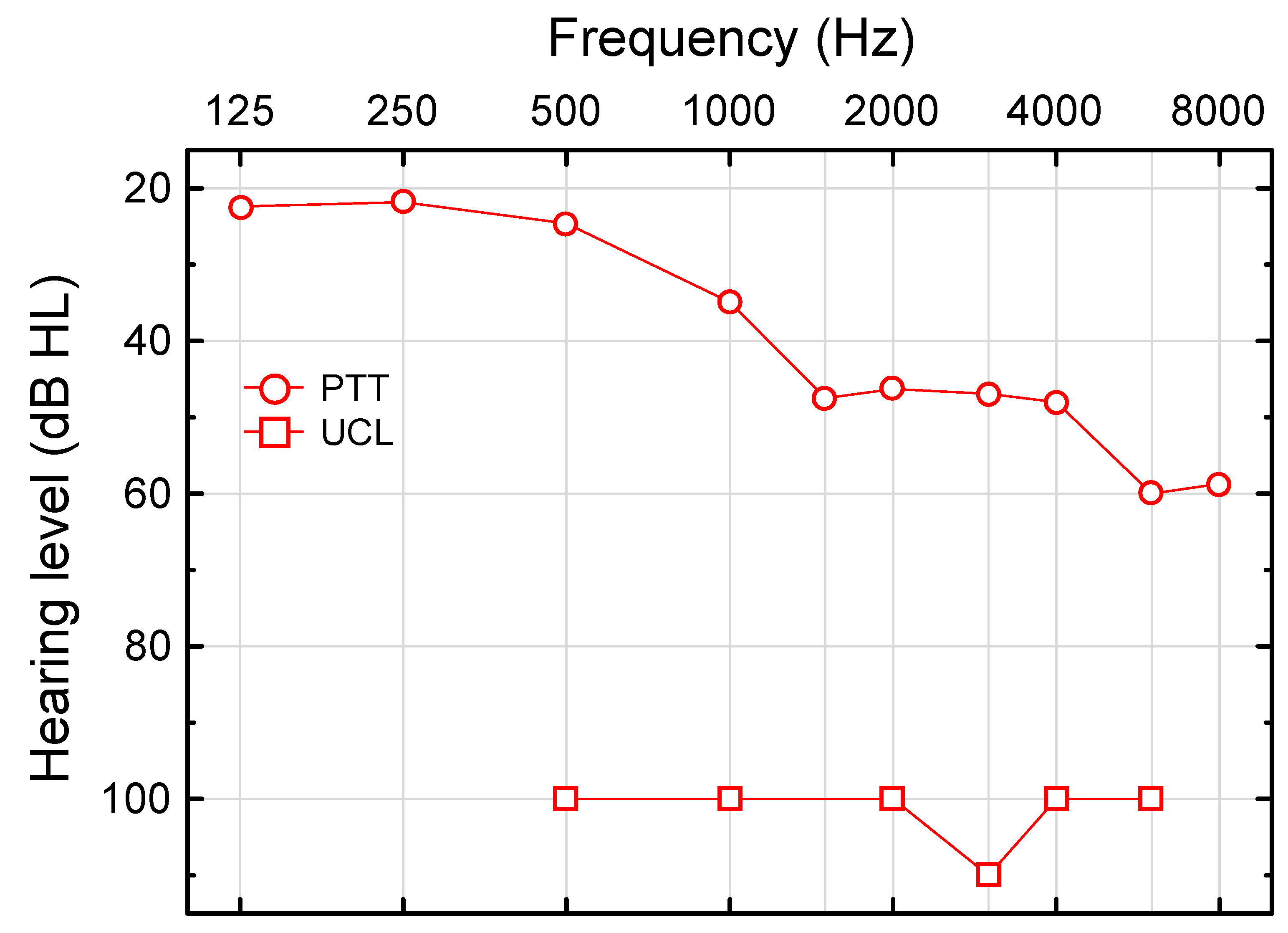 A diagram for plotting findings for tympanometry and acoustic reflexes