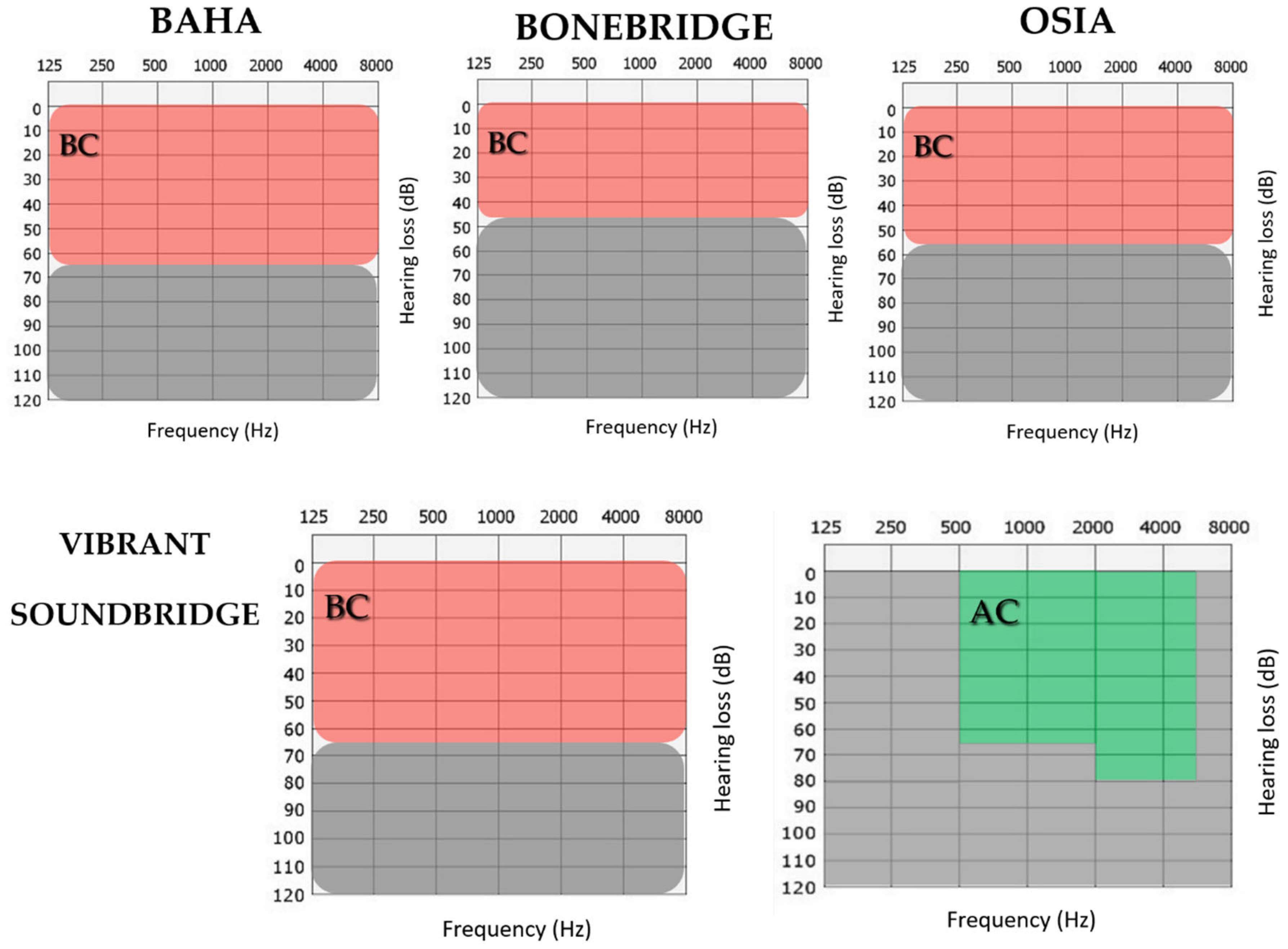 Beyond the Air–Bone Gap: The Role of Bone Conduction Thresholds in ...