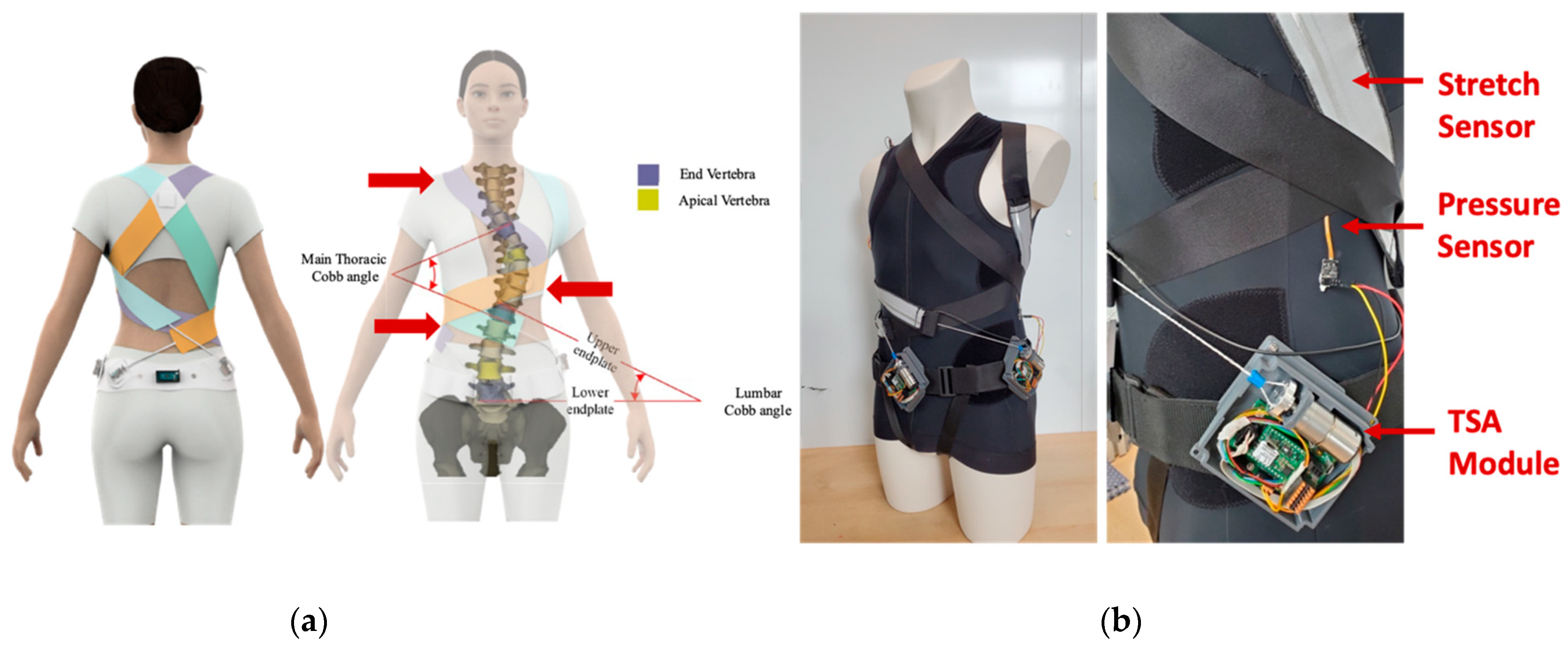 Engineering students focus on scoliosis brace comfort, fit, design