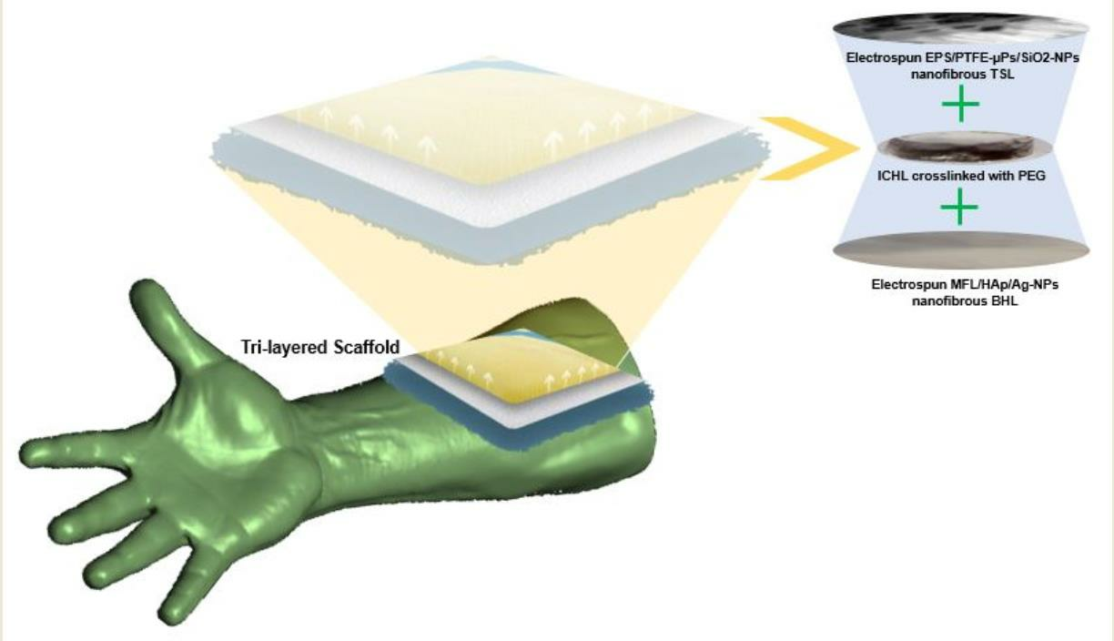 Teflon Glove, Withstands temperatures up to 450 degrees, and does