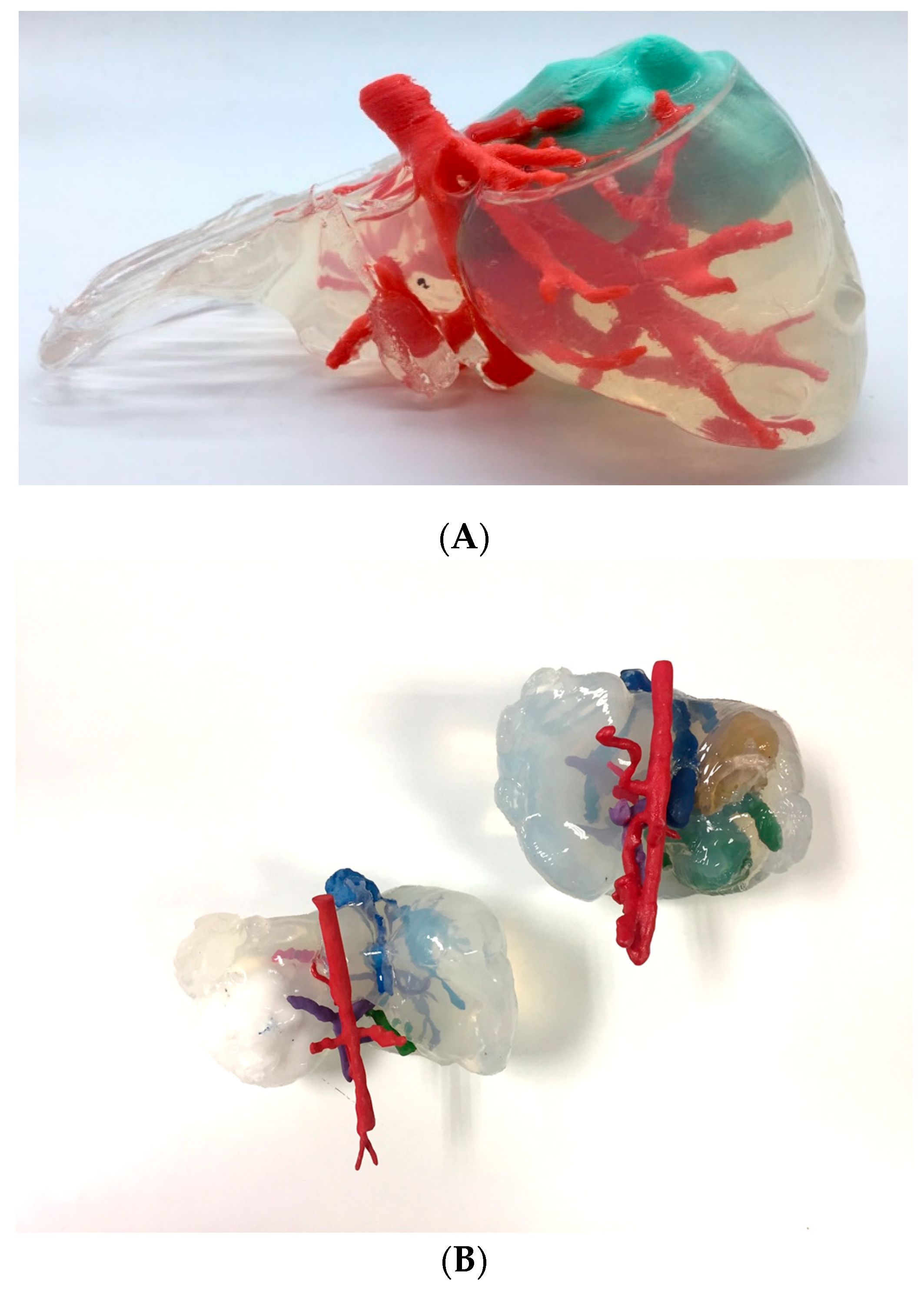 The STL images of two geometries of the 3D-printed bioceramic model