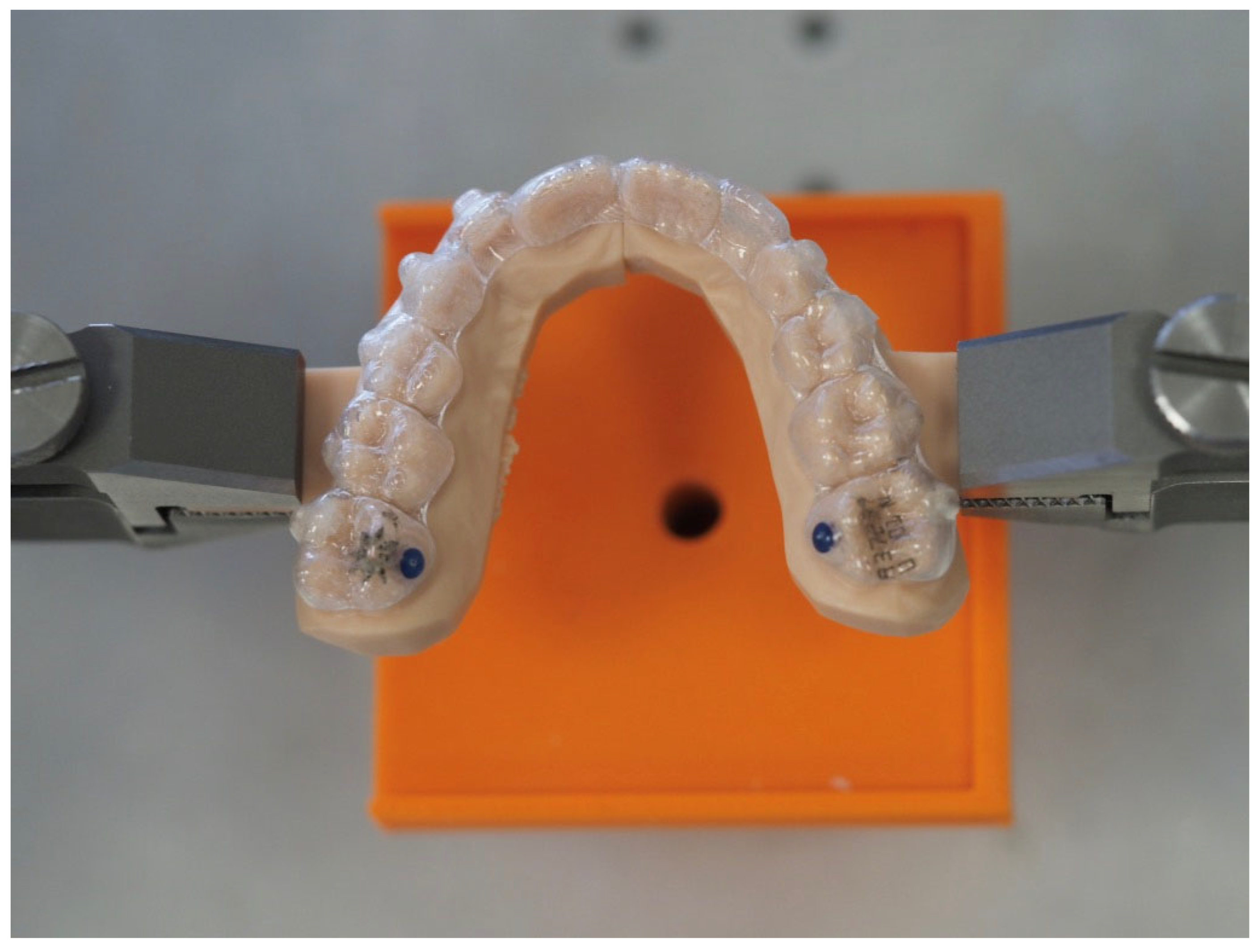 Align Technology Introduces the Invisalign® Palatal Expander System to  Address Skeletal Expansion in Growing Patients, Including Teenage Patients  Which Represent the Majority of Orthodontic Case Starts Globally