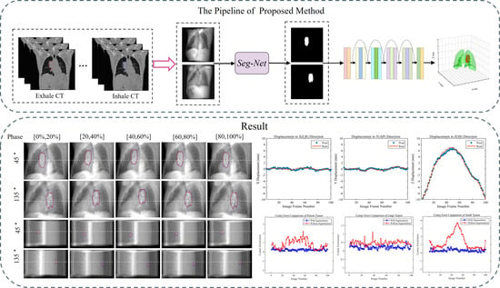 Robust Real-Time Cancer Tracking via Dual-Panel X-Ray Images for ...