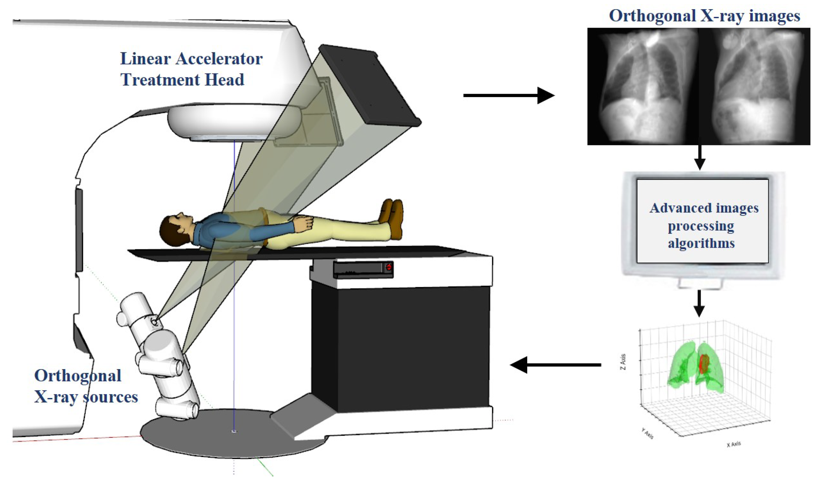 Robust Real-Time Cancer Tracking via Dual-Panel X-Ray Images for ...