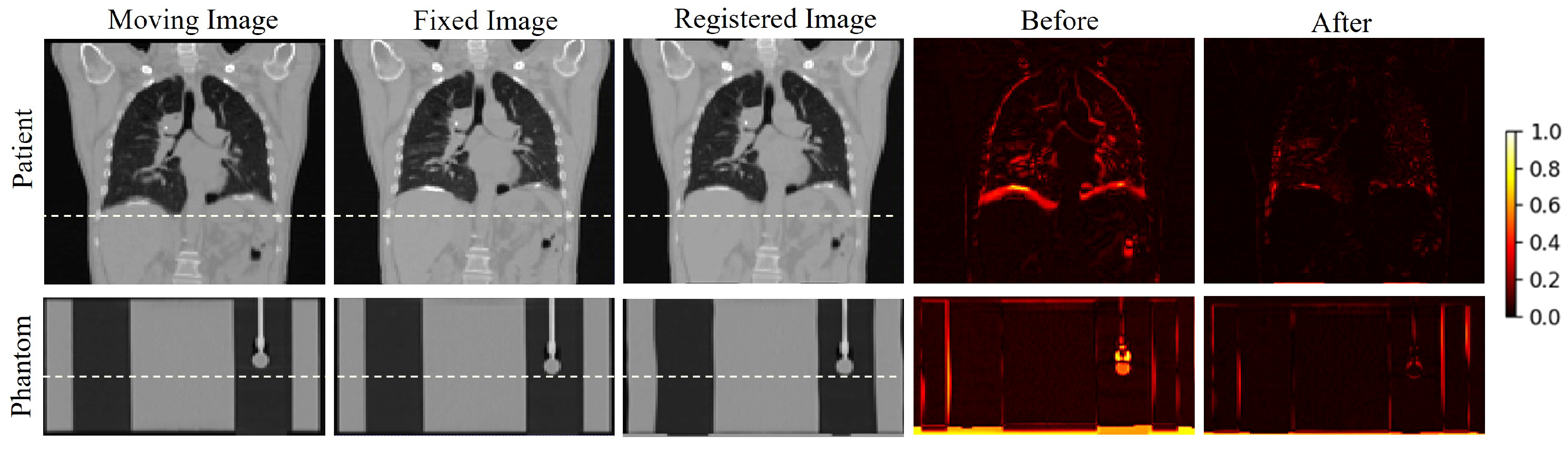 Robust Real-Time Cancer Tracking via Dual-Panel X-Ray Images for ...