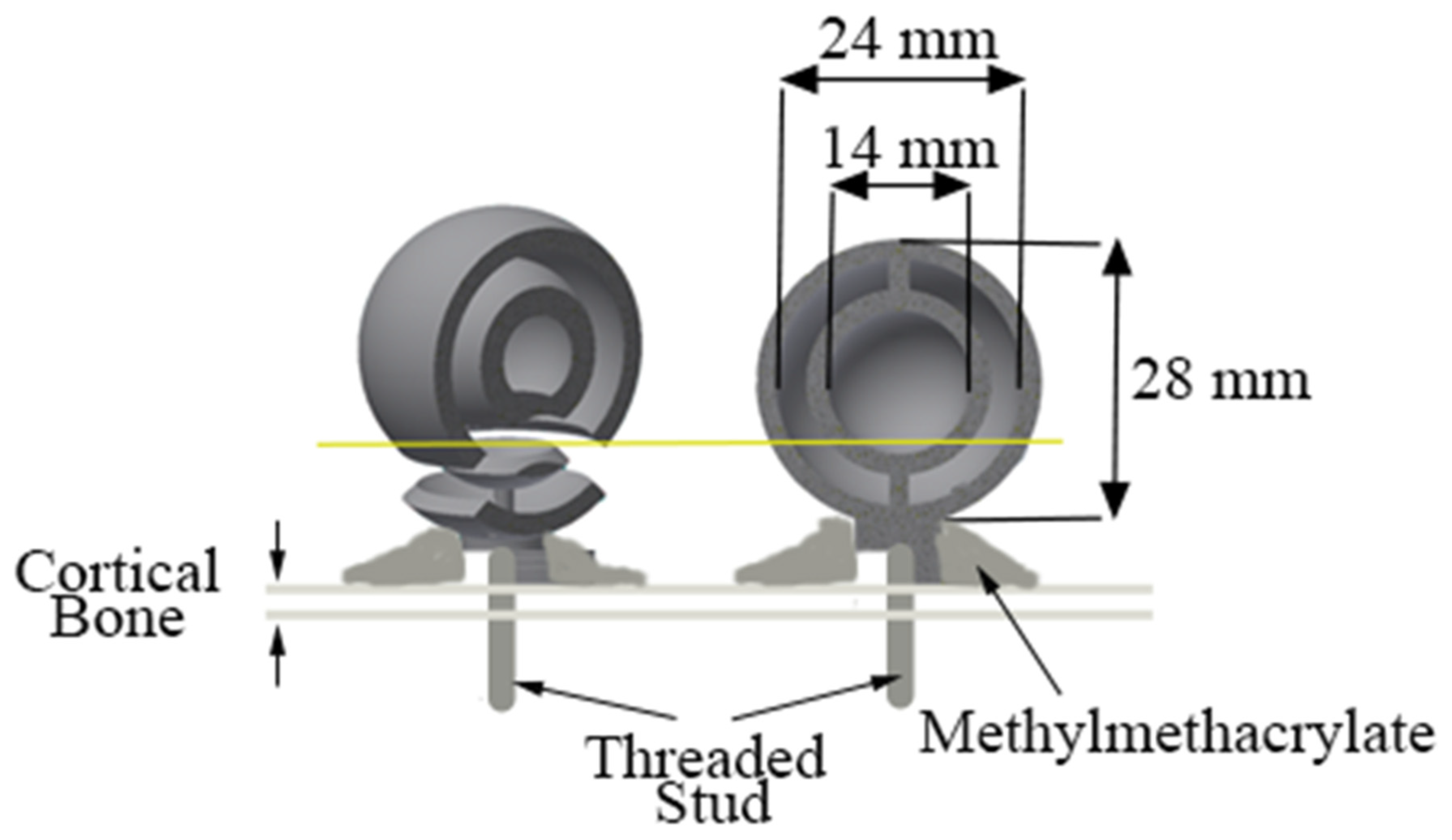 Unbiased Method To Determine Articular Cartilage Thickness Using A ...