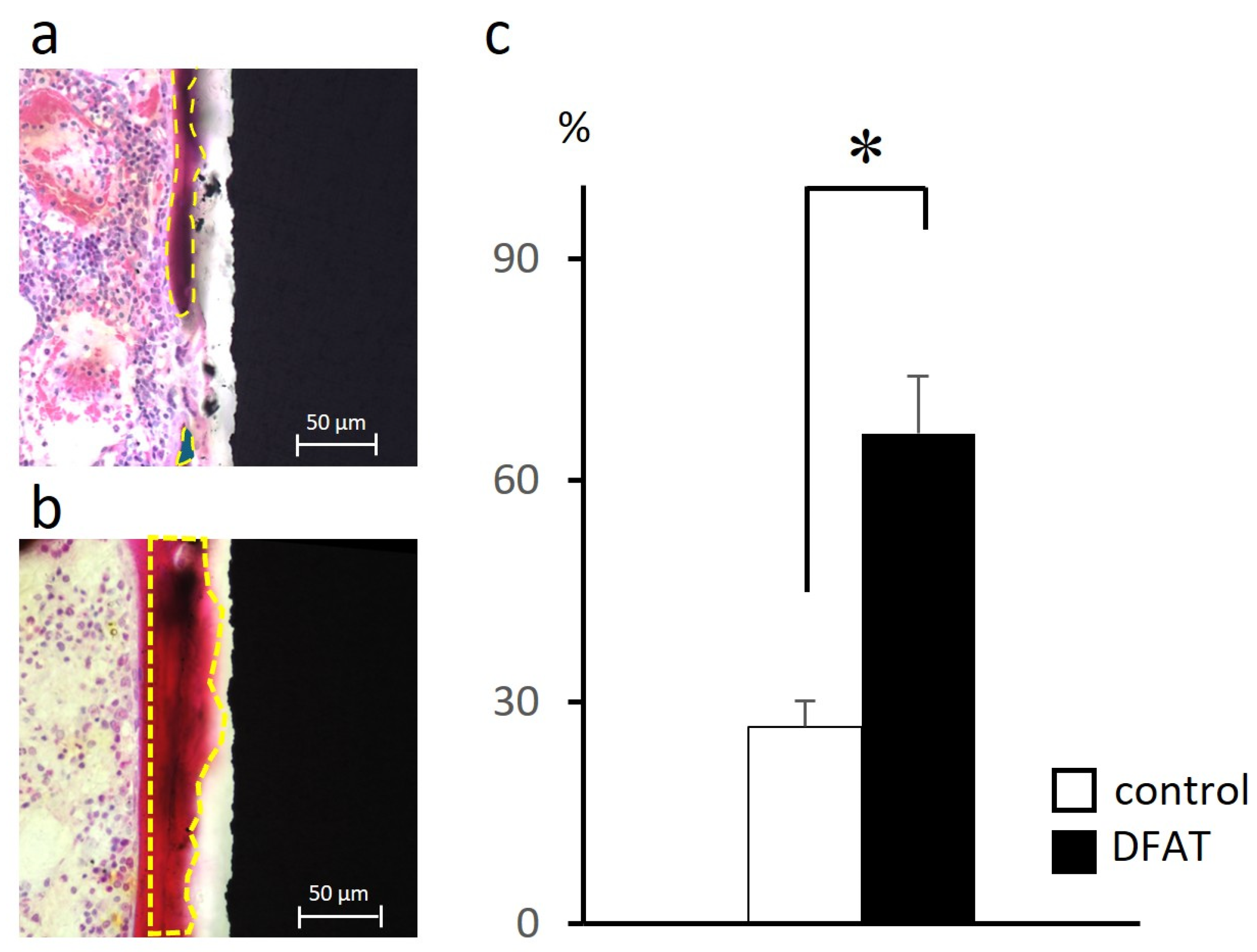 Augmenting Bone Formation by Implanting Dedifferentiated Fat Cell ...