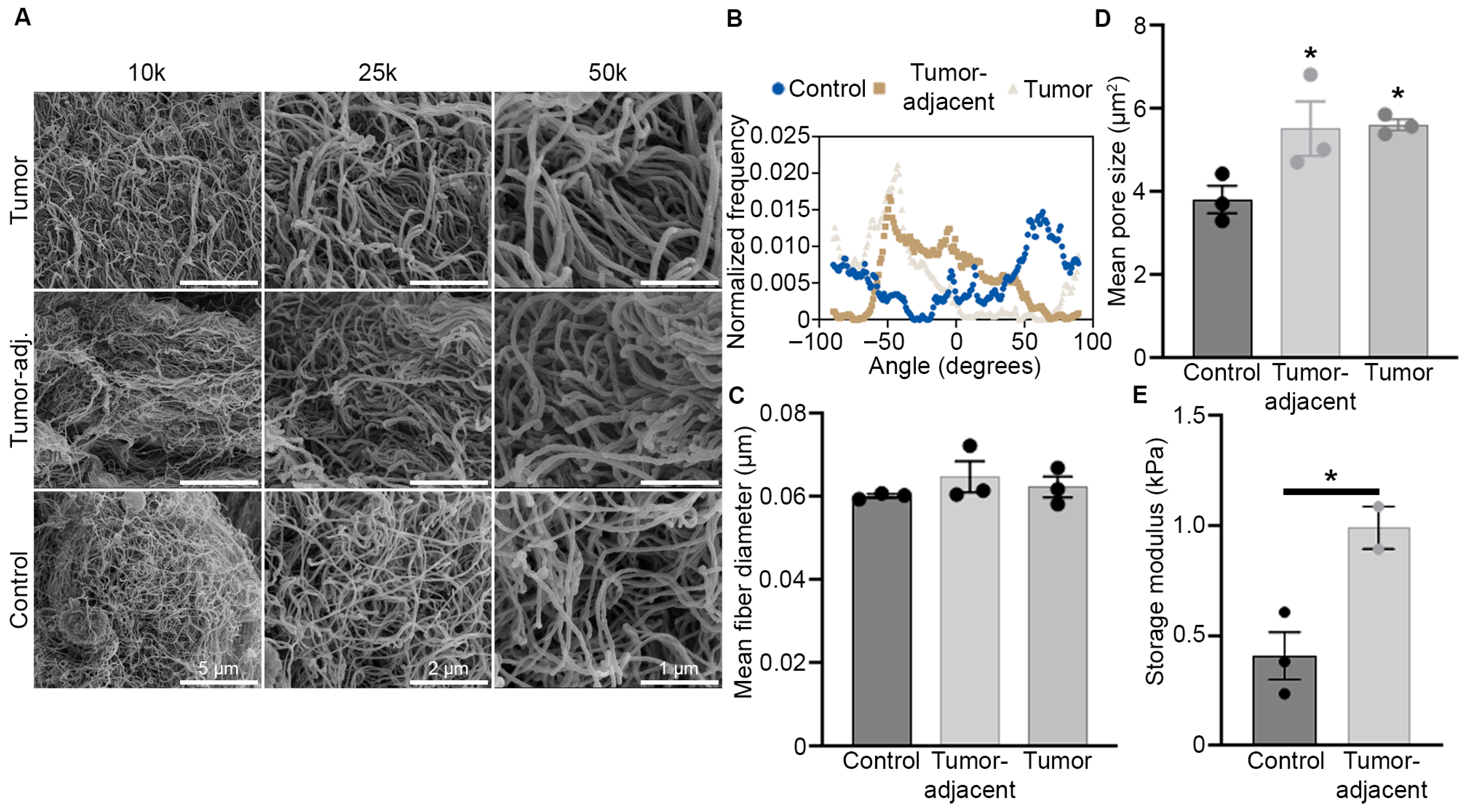 Evaluation of Metaplastic Triple-Negative Breast Cancer Extracellular ...