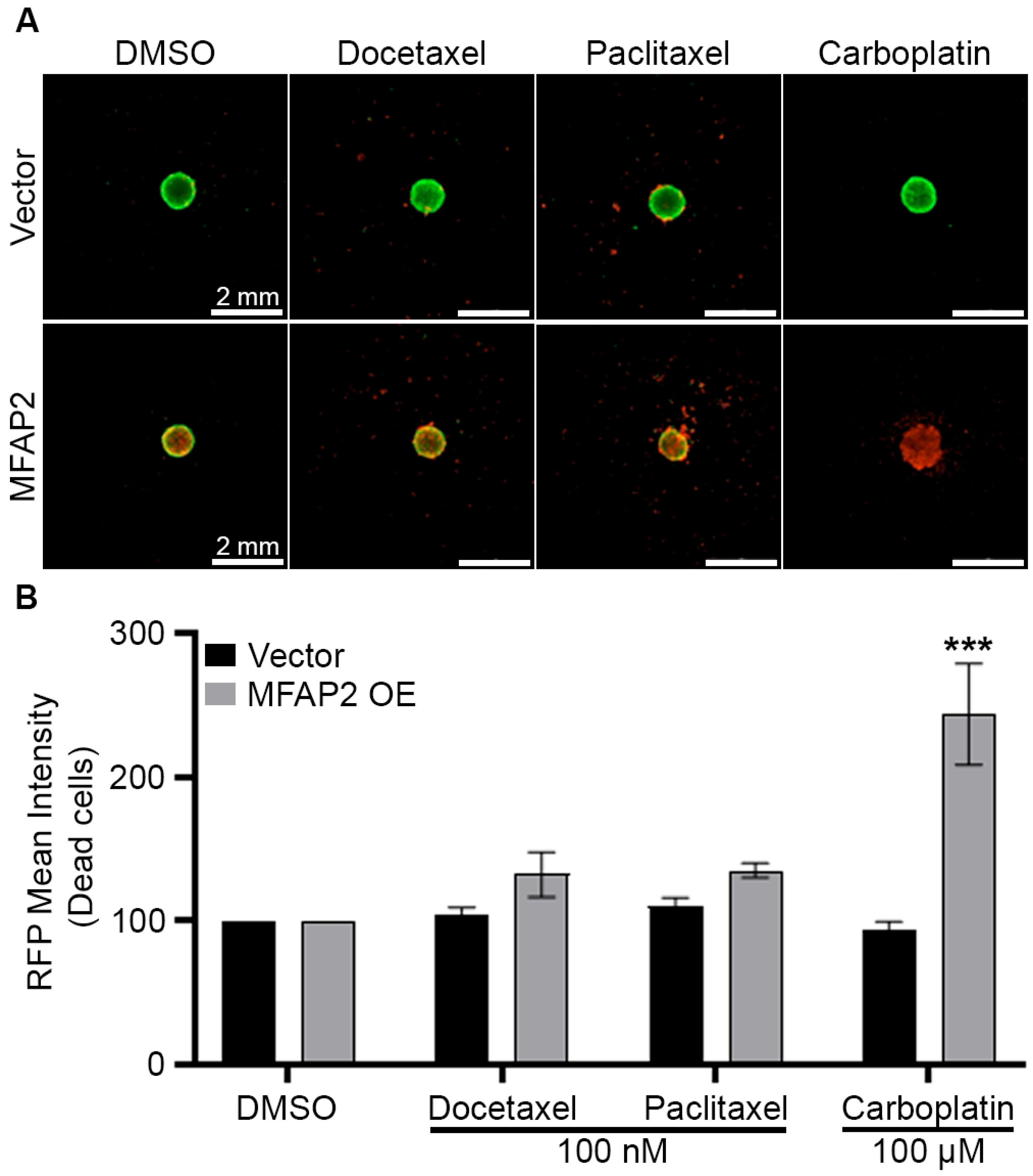 Evaluation of Metaplastic Triple-Negative Breast Cancer Extracellular ...