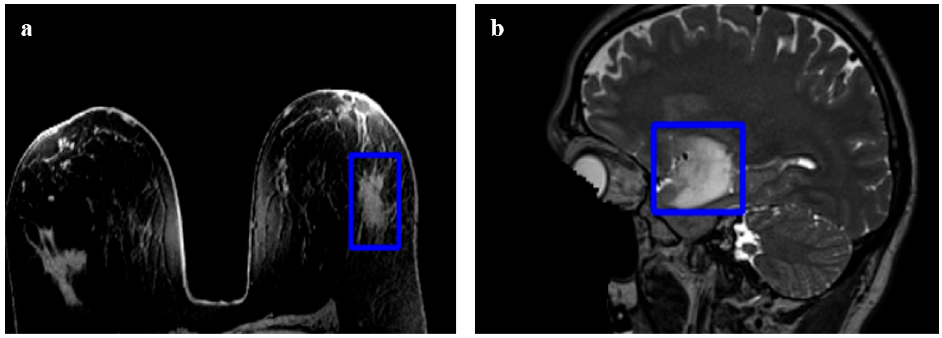 3D Medical Image Segmentation with 3D Modelling