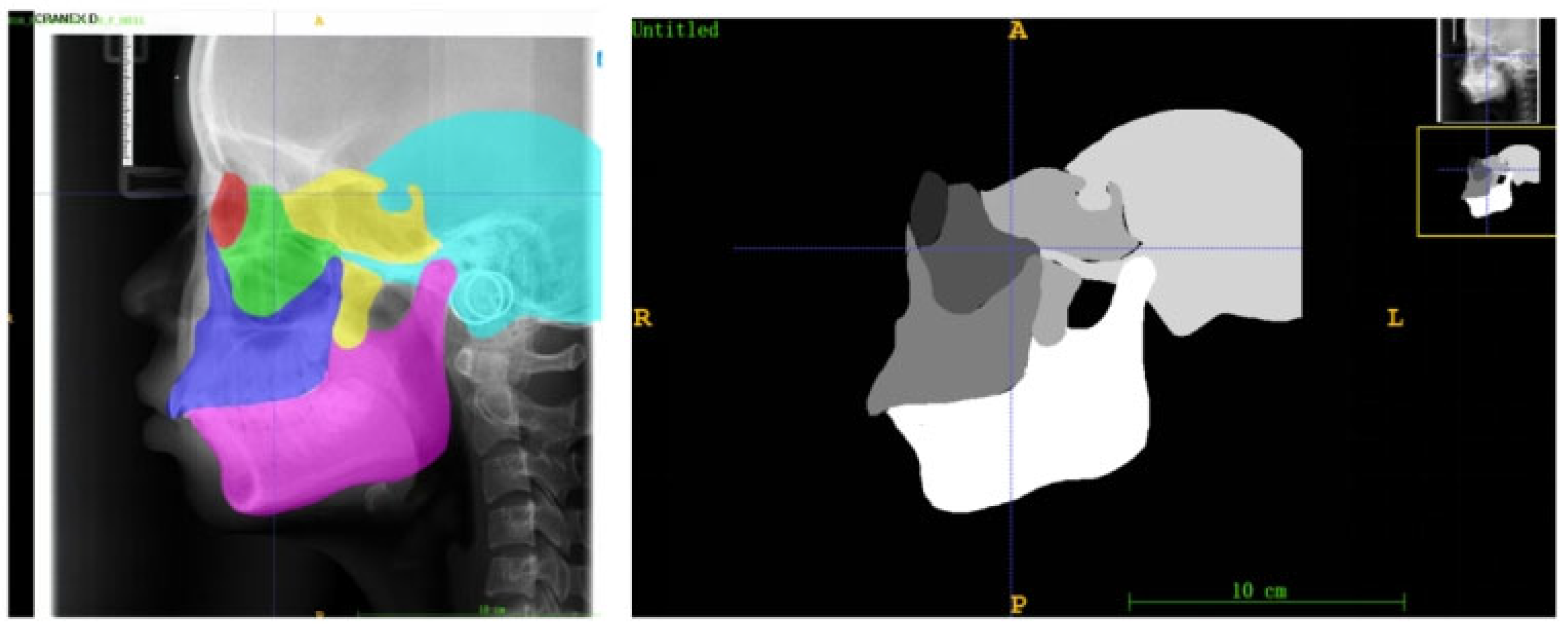 Quantification of Craniofacial Growth Pattern Based on Deep Learning