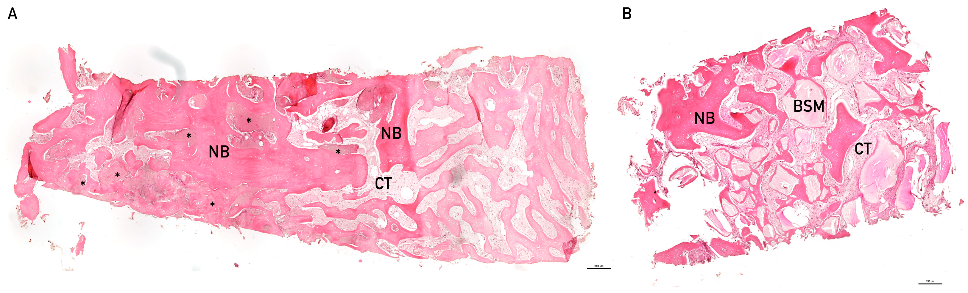 Alveolar Ridge Preservation Revisited: A Multimodal Evaluation of Bone ...