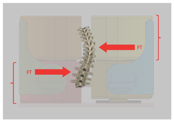 Compression Brace Engineering Mechanical Modeling and Experimental Validation of a Front-Push ...