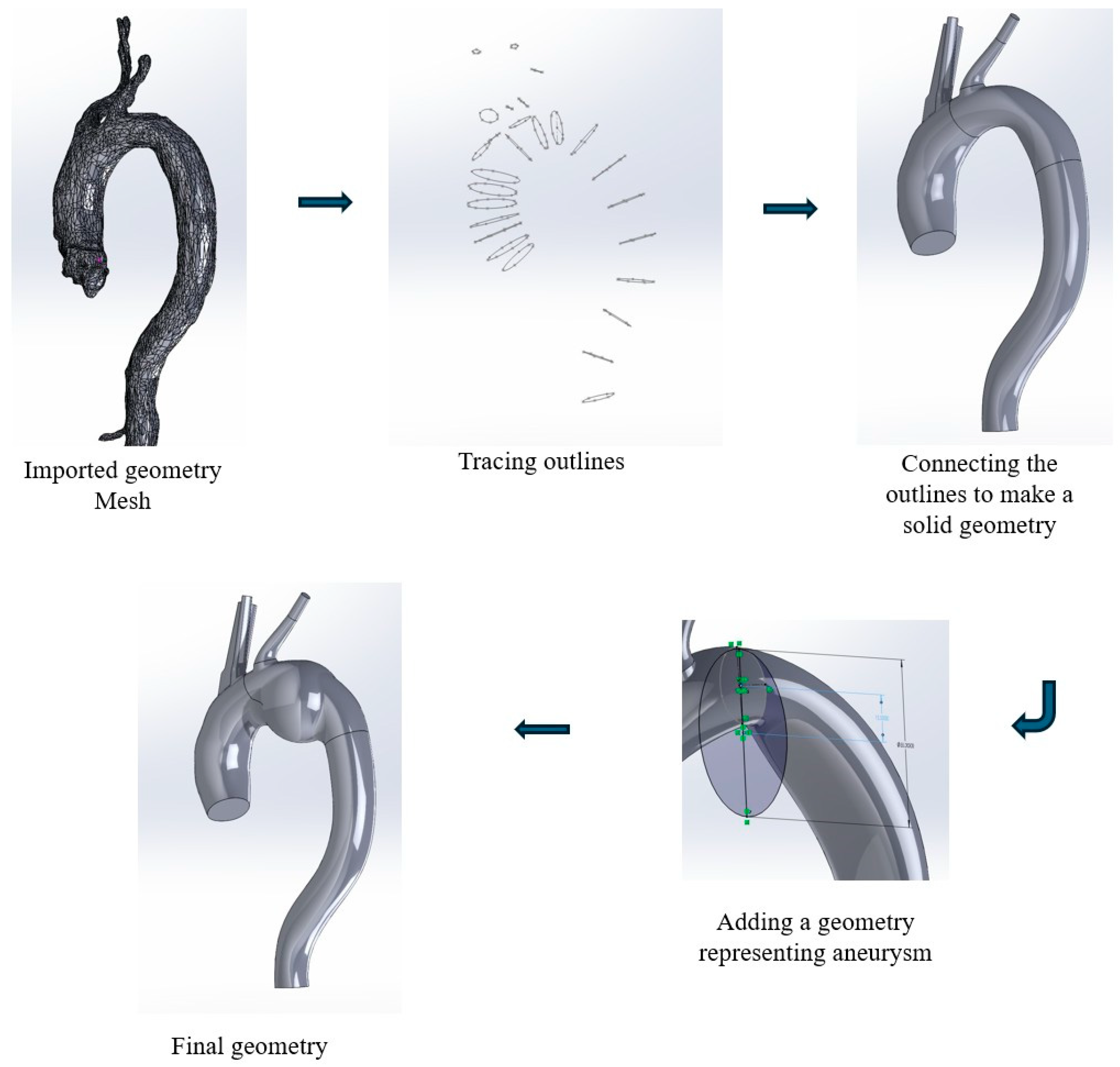 Hemodynamic Alterations Associated with Varying Aneurysm Sizes in the ...