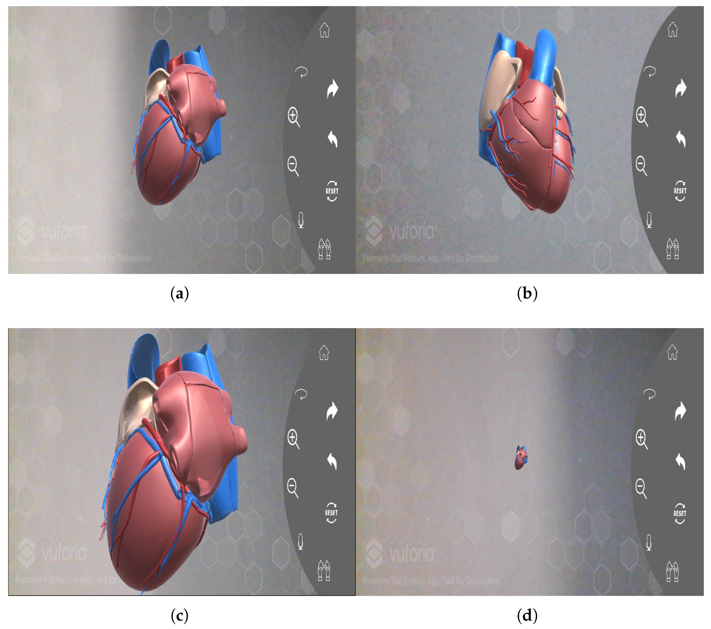Leveraging 3D Heart Visualisation and Data Balancing Techniques for ECG ...