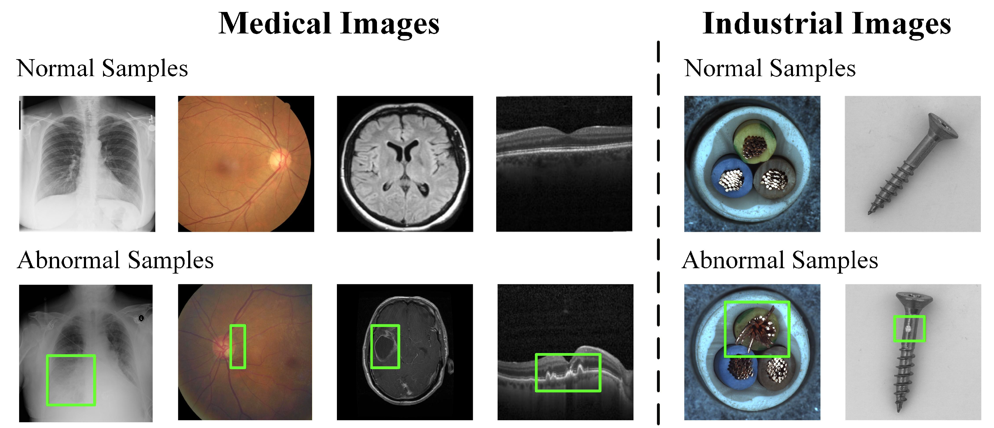 Medical Anomaly Rip Unsupervised Anomaly Detection in Medical Imaging: A Survey of Methods ...