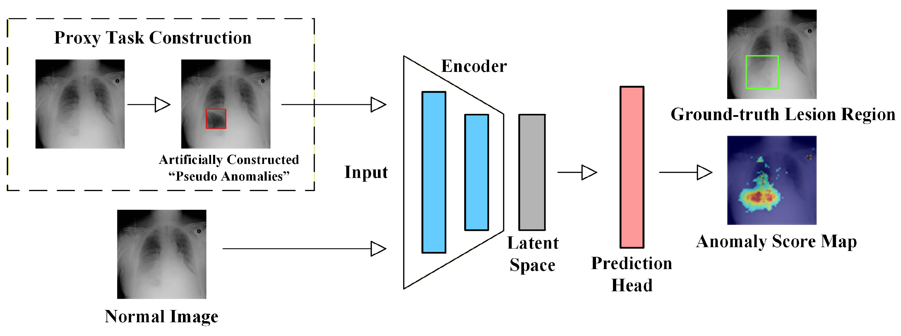Unsupervised Anomaly Detection in Medical Imaging: A Survey of Methods ...