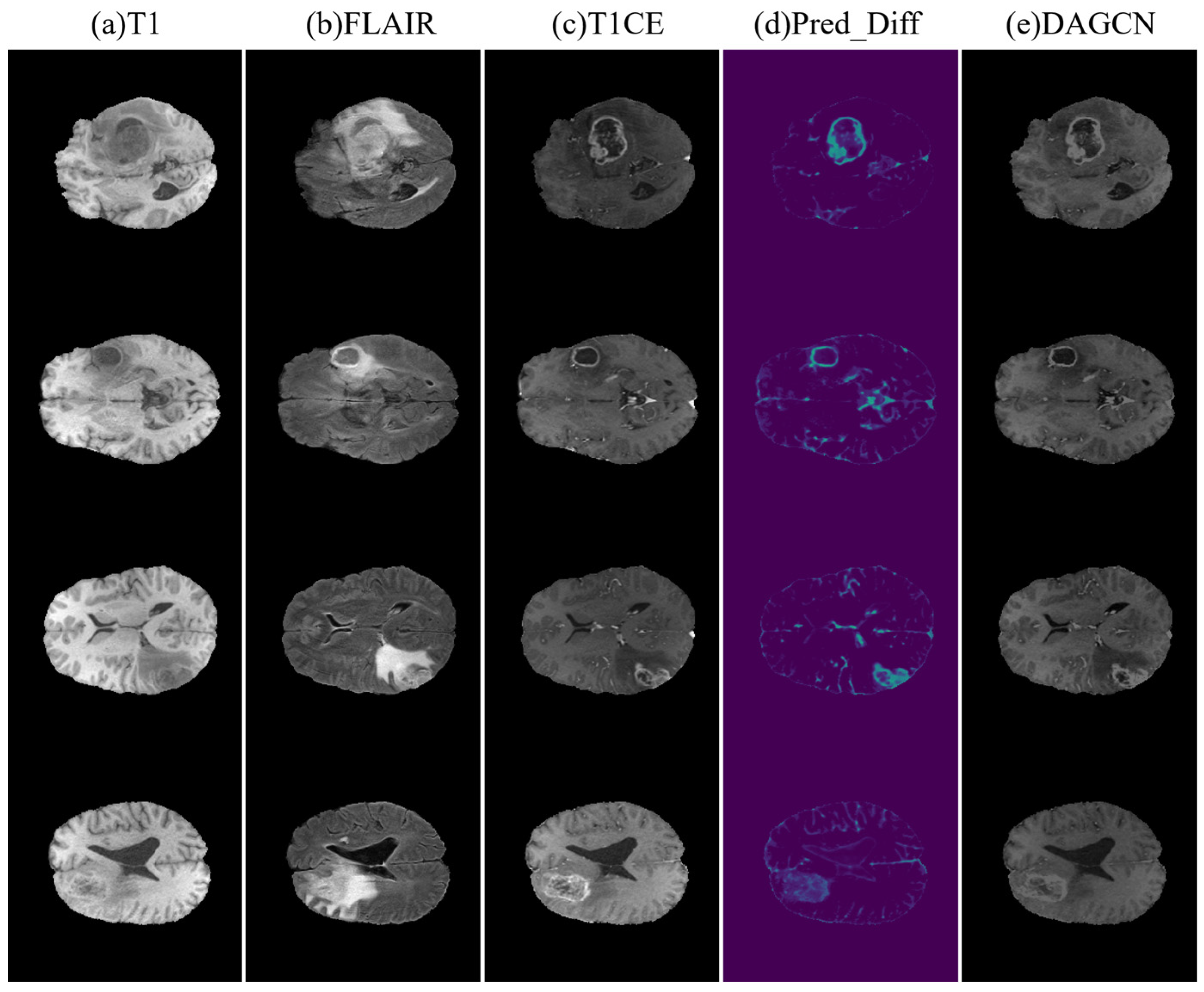 Multi-Sequence Guided Generation of Contrast-Enhanced Magnetic ...