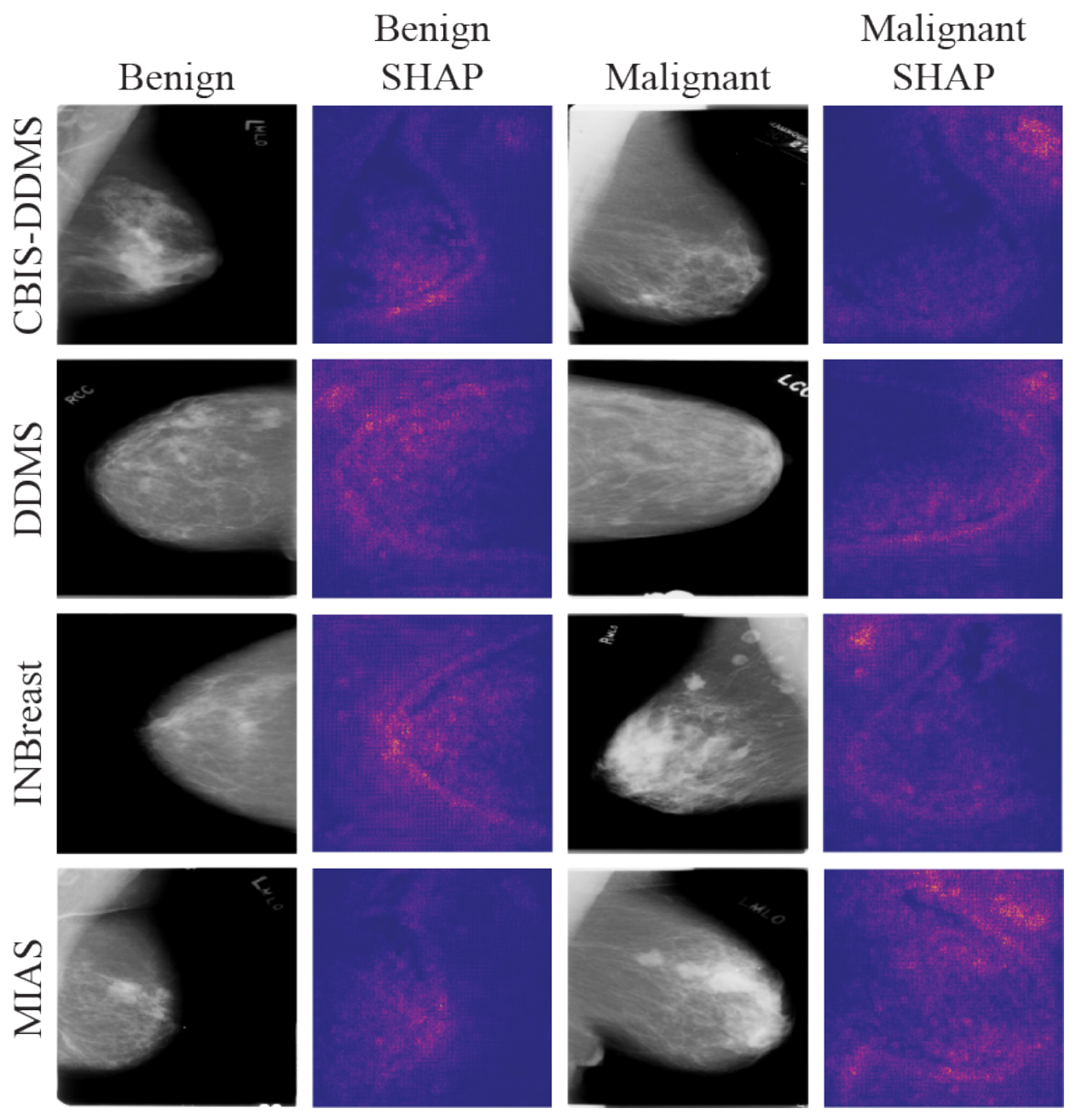 Explainable Breast Cancer Detection Using Hierarchical Multi-Scale and ...