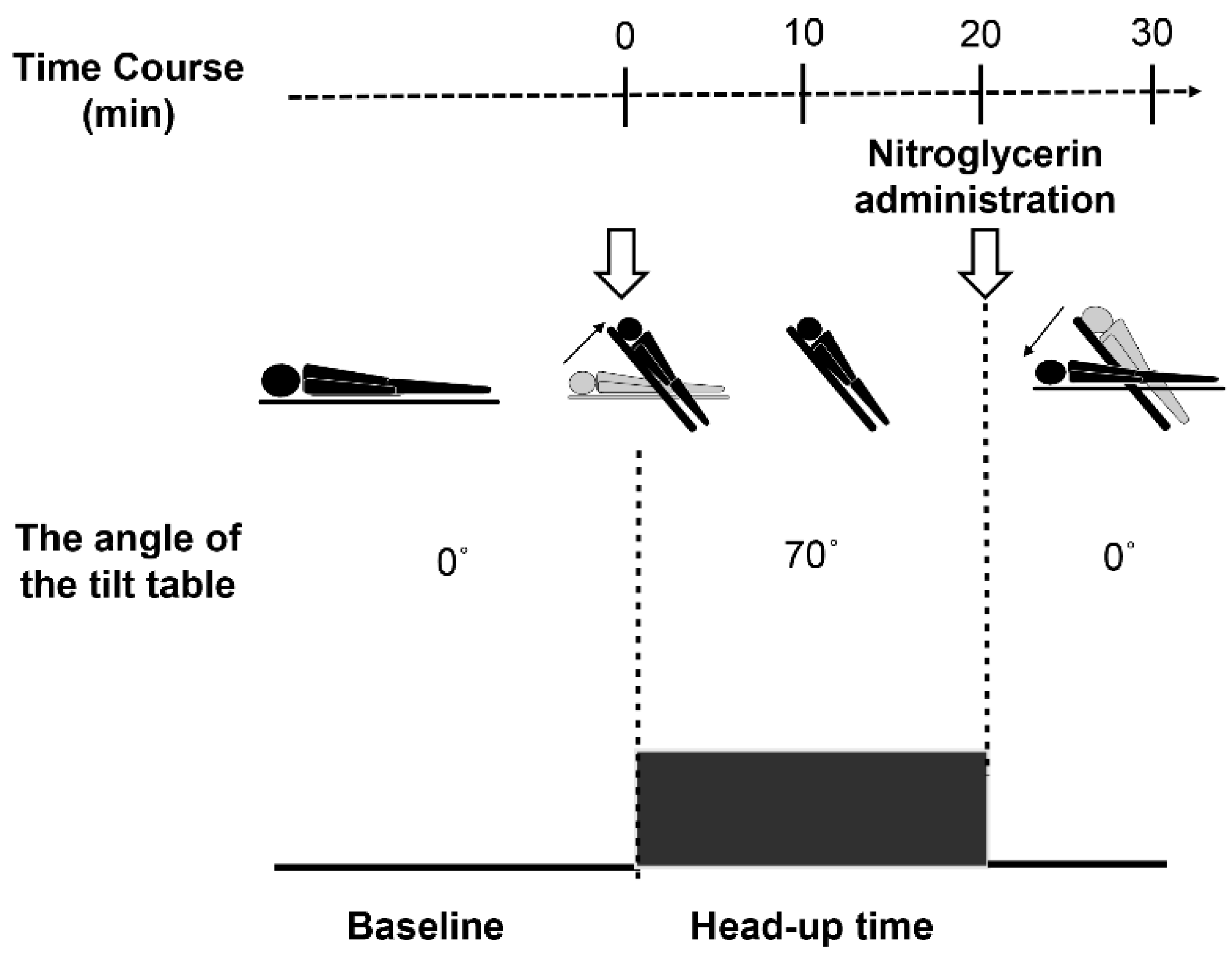 Tilt Table Test