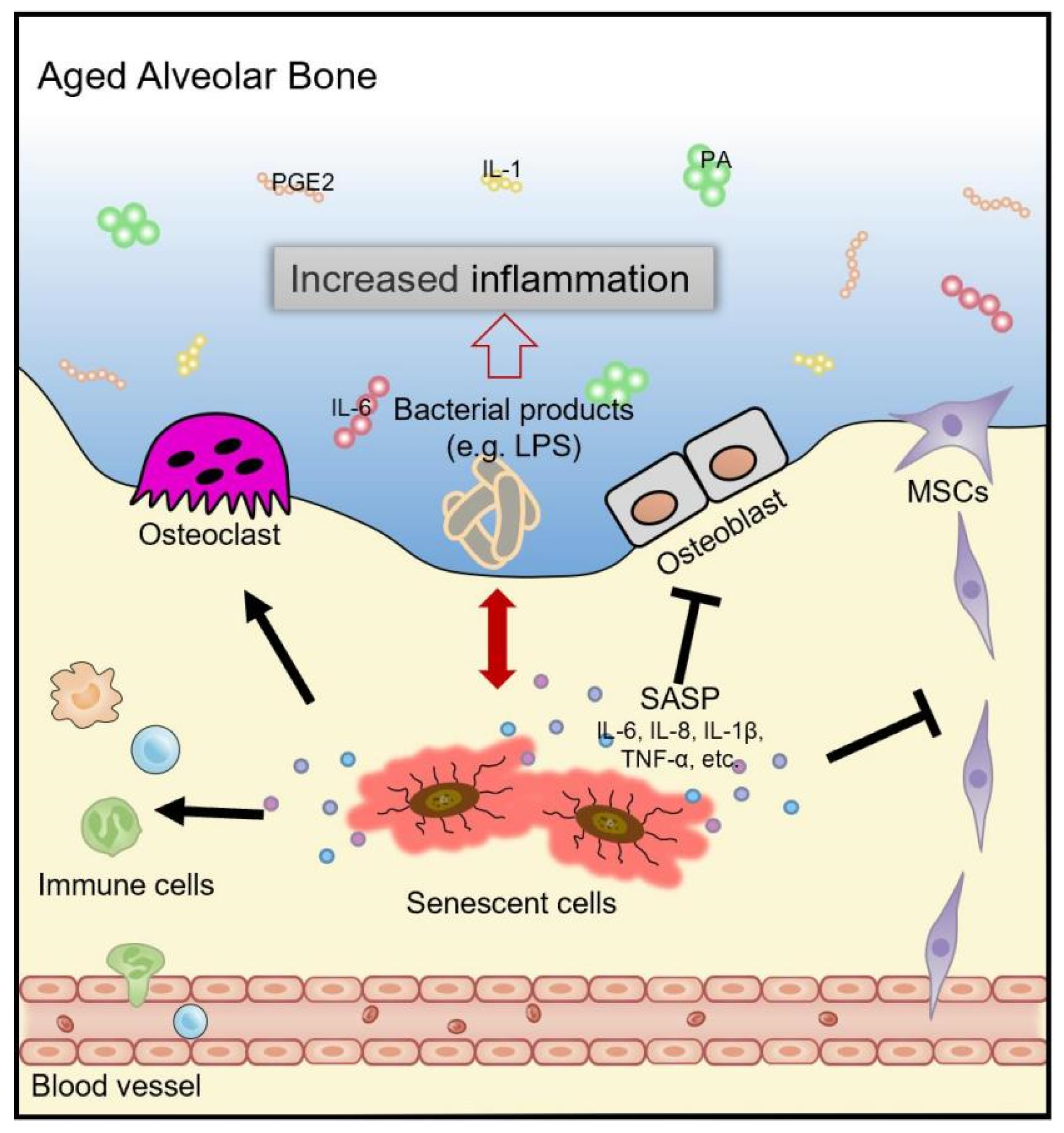 Biology Free Full Text Cellular Senescence And Periodontitis Biology Free Full Text Cellular Senescence And Periodontitis