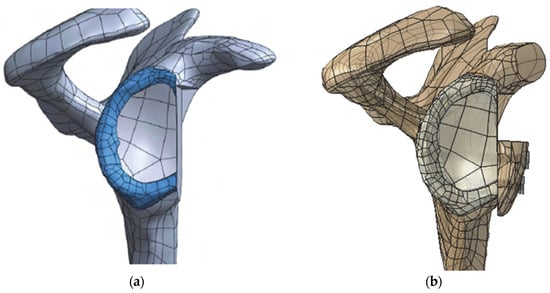 Biology | Free Full-Text | Influence of Graft Positioning during the ...