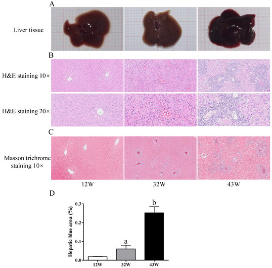 Establishment of a Spontaneous Liver Fibrosis Model in NOD/SCID Mice ...