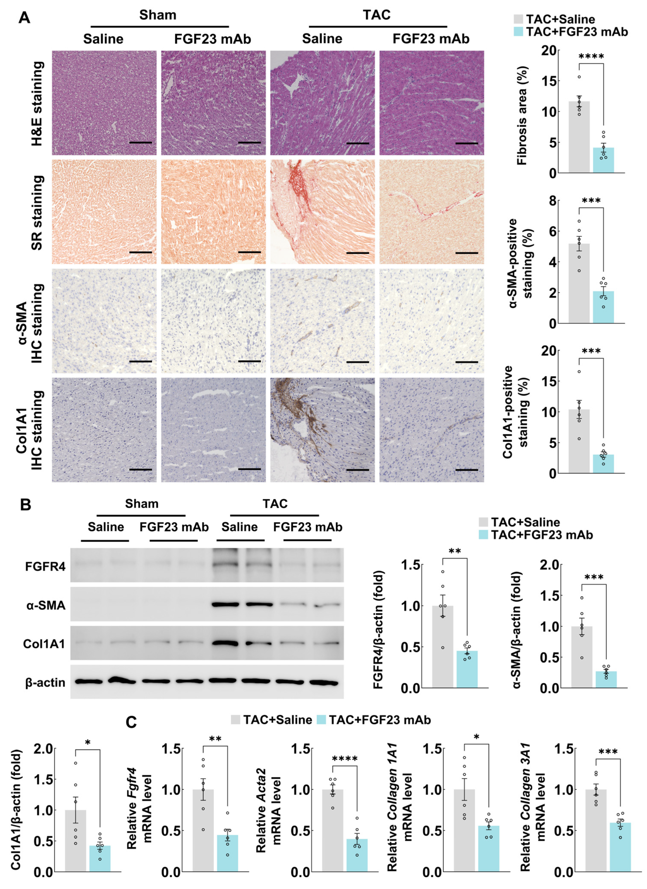 FGF23 Controls Myocardial Fibrosis Progression via Promoting Cardiac ...