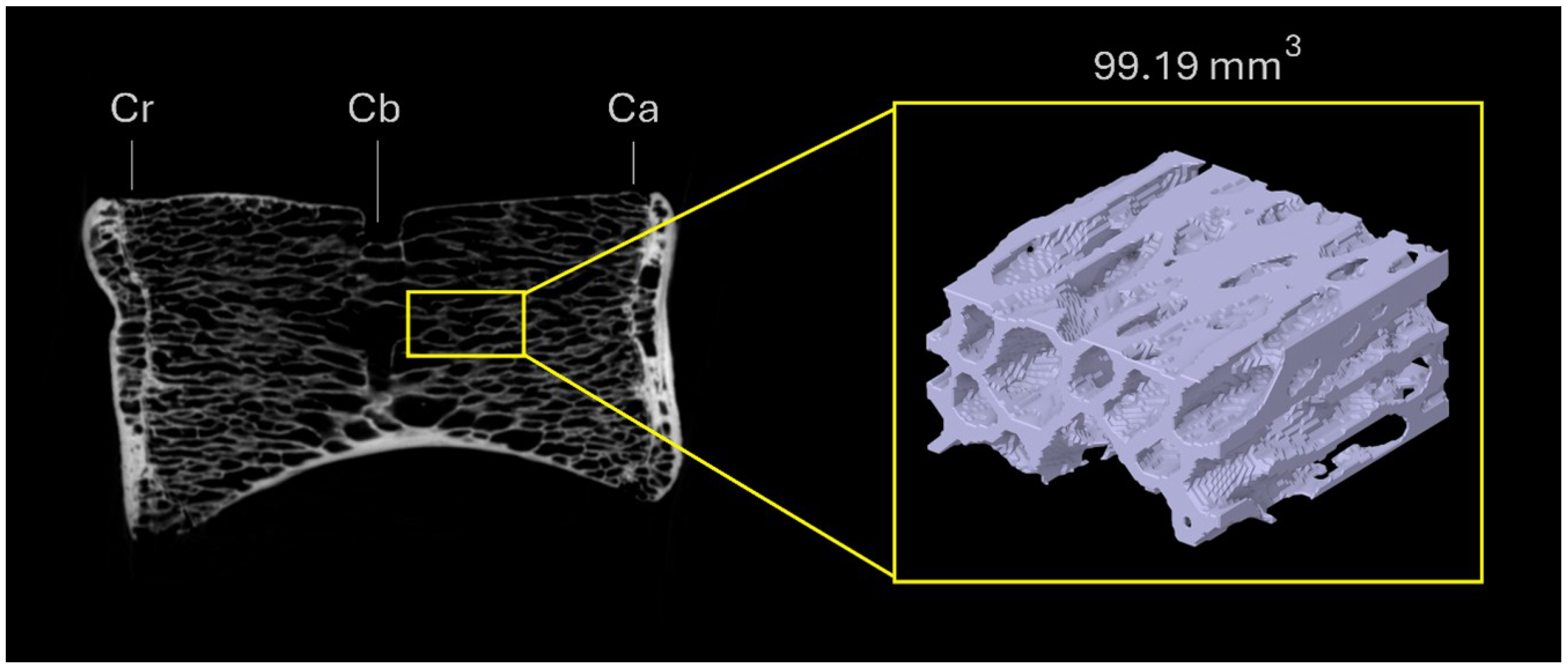 A Specimen-Based Comparative MicroCT–FEA Analysis of Vertebral ...