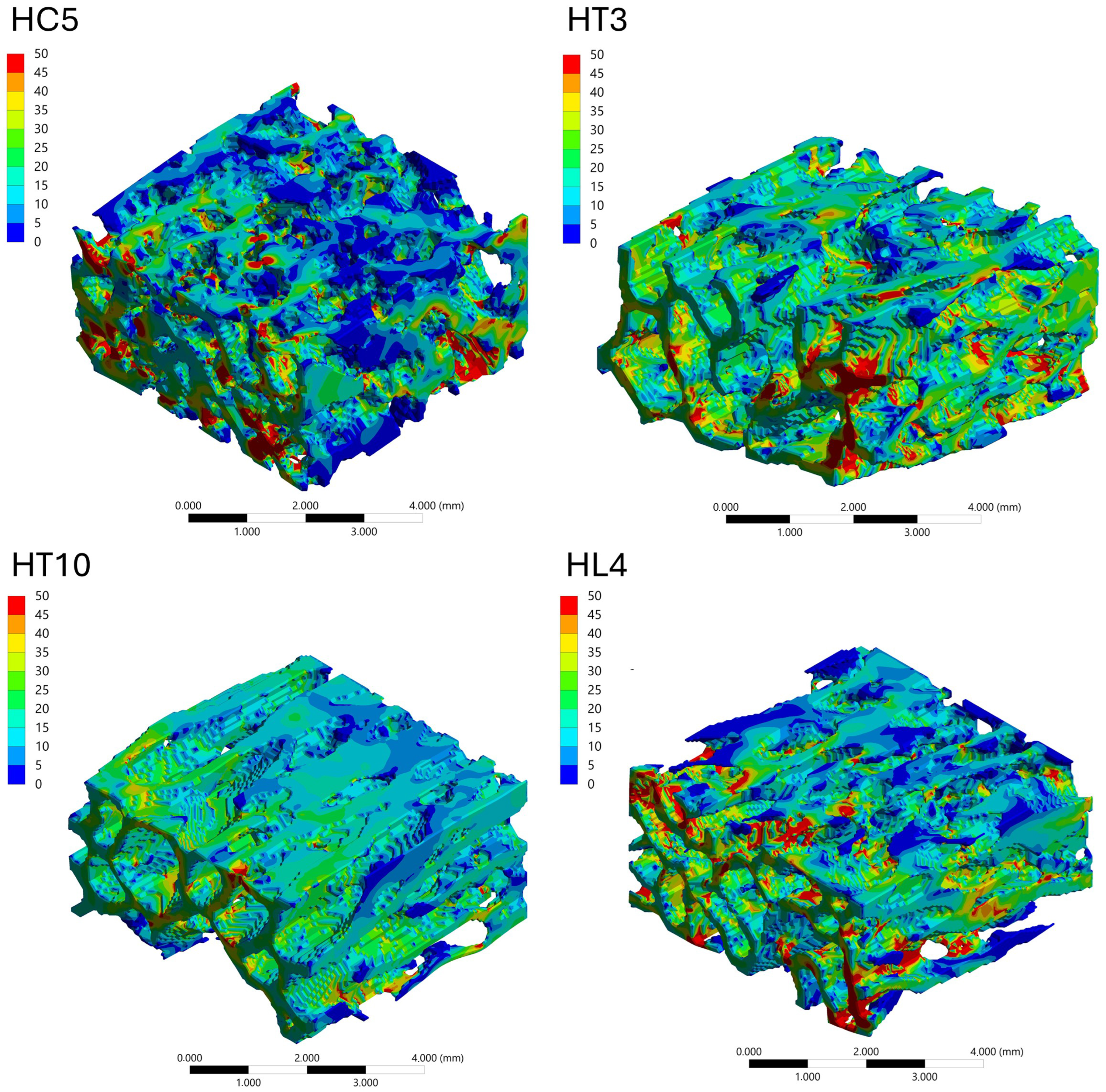 A Specimen-Based Comparative MicroCT–FEA Analysis of Vertebral ...