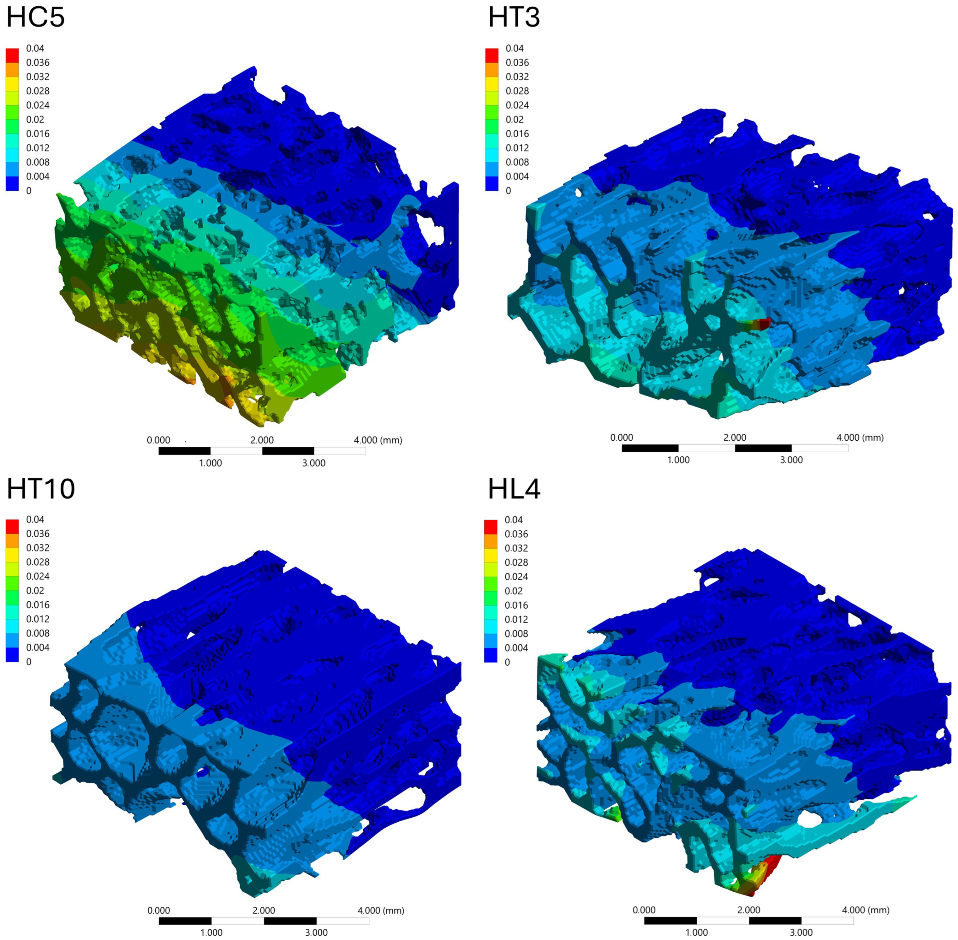 A Specimen-Based Comparative MicroCT–FEA Analysis of Vertebral ...
