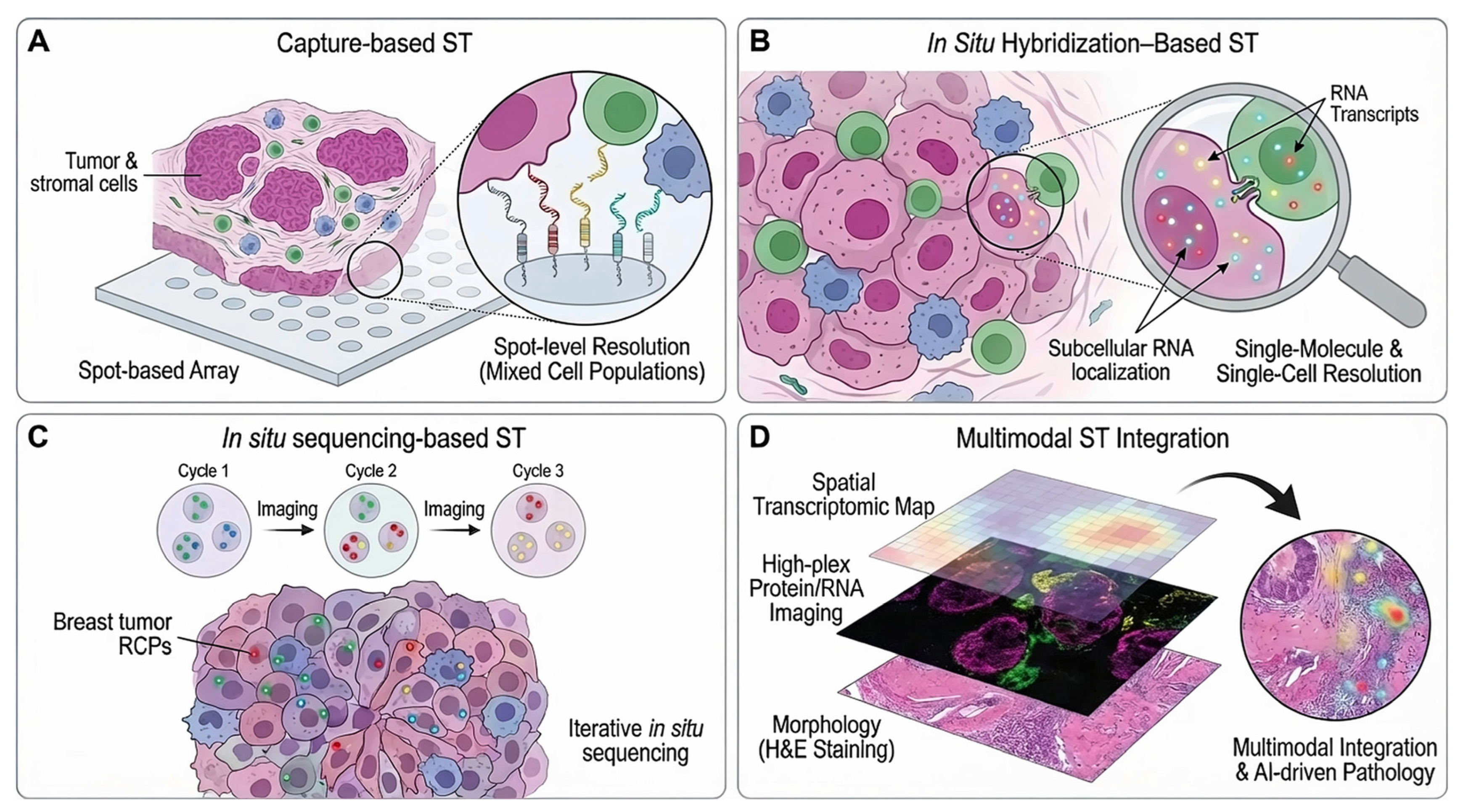 Spatial Transcriptomics in Breast Cancer: Advances and Applications