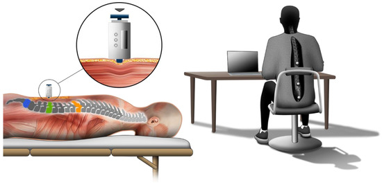 Biomechanics | Free Full-Text | The Effect of Sitting Posture and ...