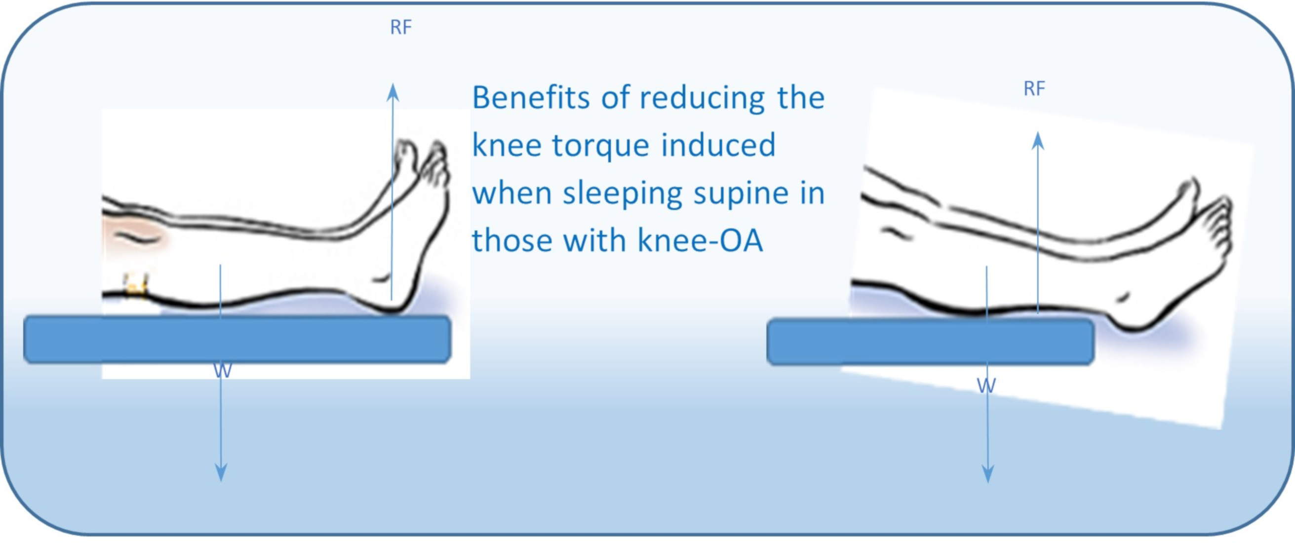 Osteoarthritis Knee Pad / Nighttime Knee Pain Relief / Knee Pillow / Knee &  Hip