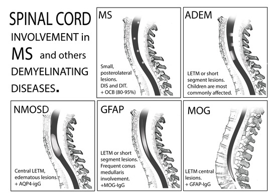 randomized panel images of different upper-to-lower pole ratios of a