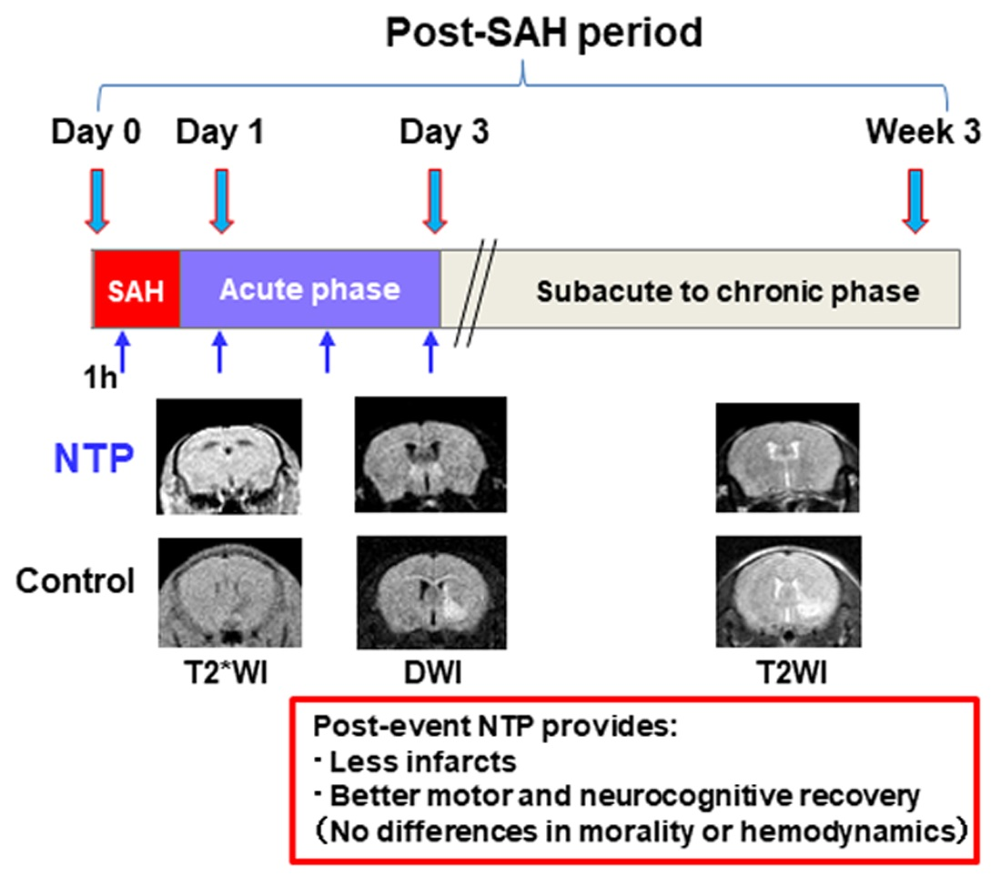 SAH Management Algorithm – Peripheral Brain