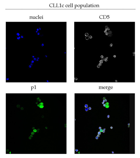 Biomedicines | Special Issue : Molecular Pathogenesis Of B-cell ...