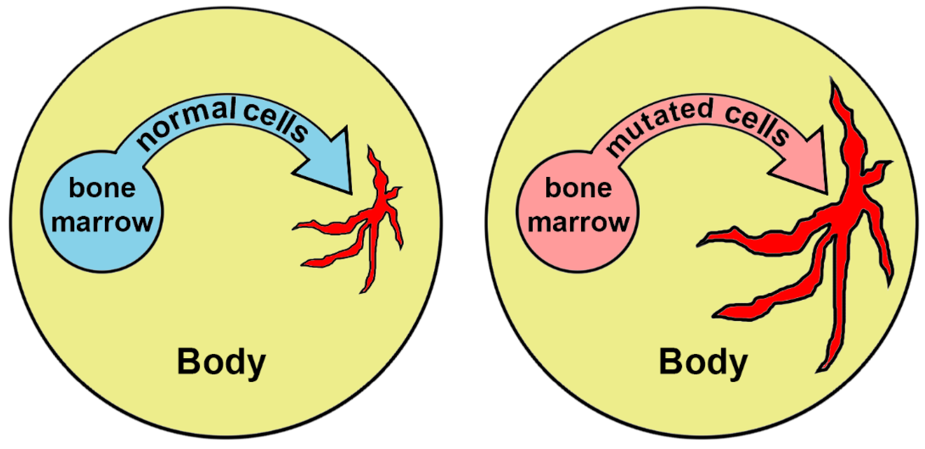 Biomedicines | Free Full-Text | Somatic Mutations of Hematopoietic Cells  Are an Additional Mechanism of Body Aging, Conducive to Comorbidity and  Increasing Chronification of Inflammation