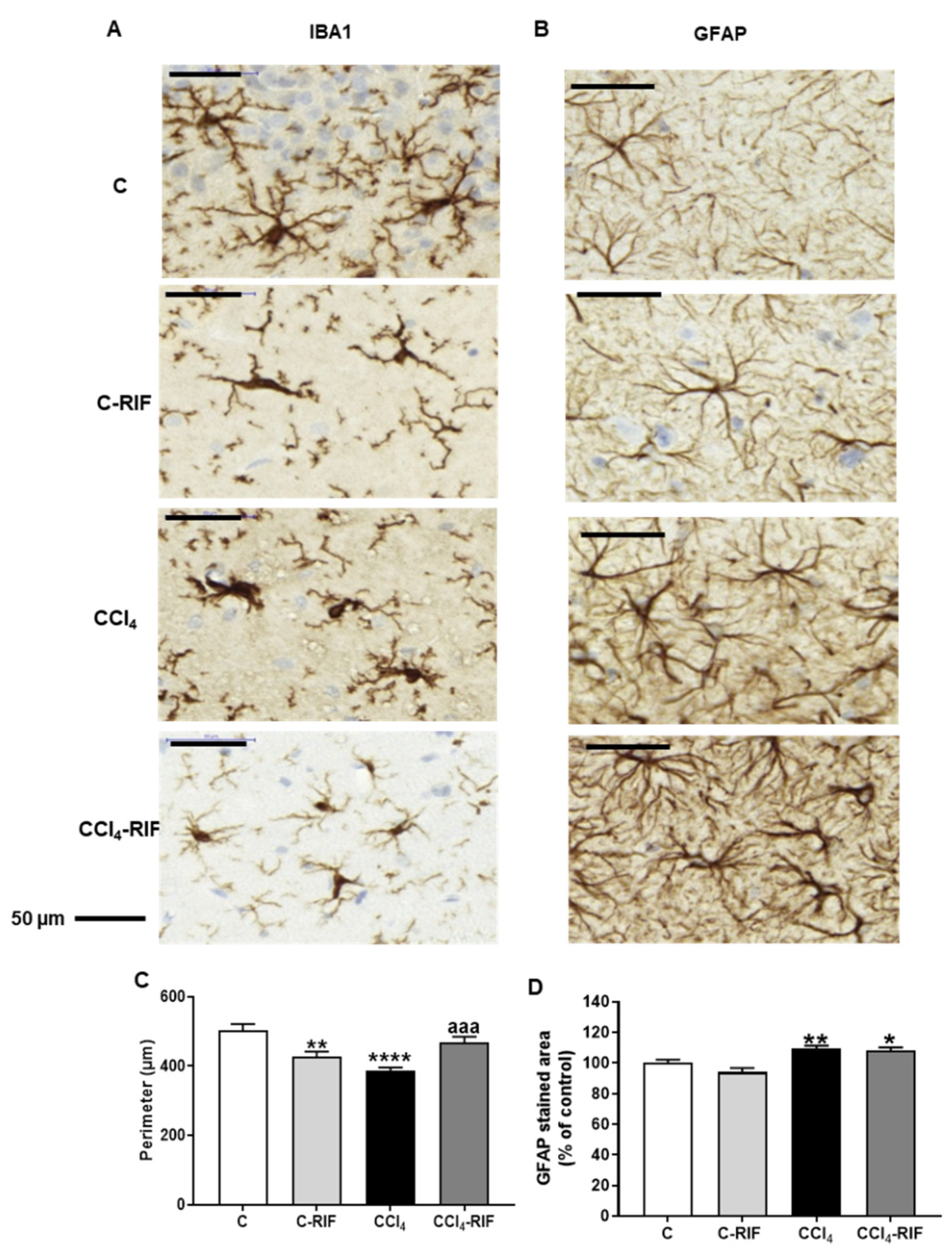 Memory Spatial Free Rats Impairment | Rifaximin Neuroinflammation Biomedicines in and Improves with Learning Liver Full-Text | Damage-Associated