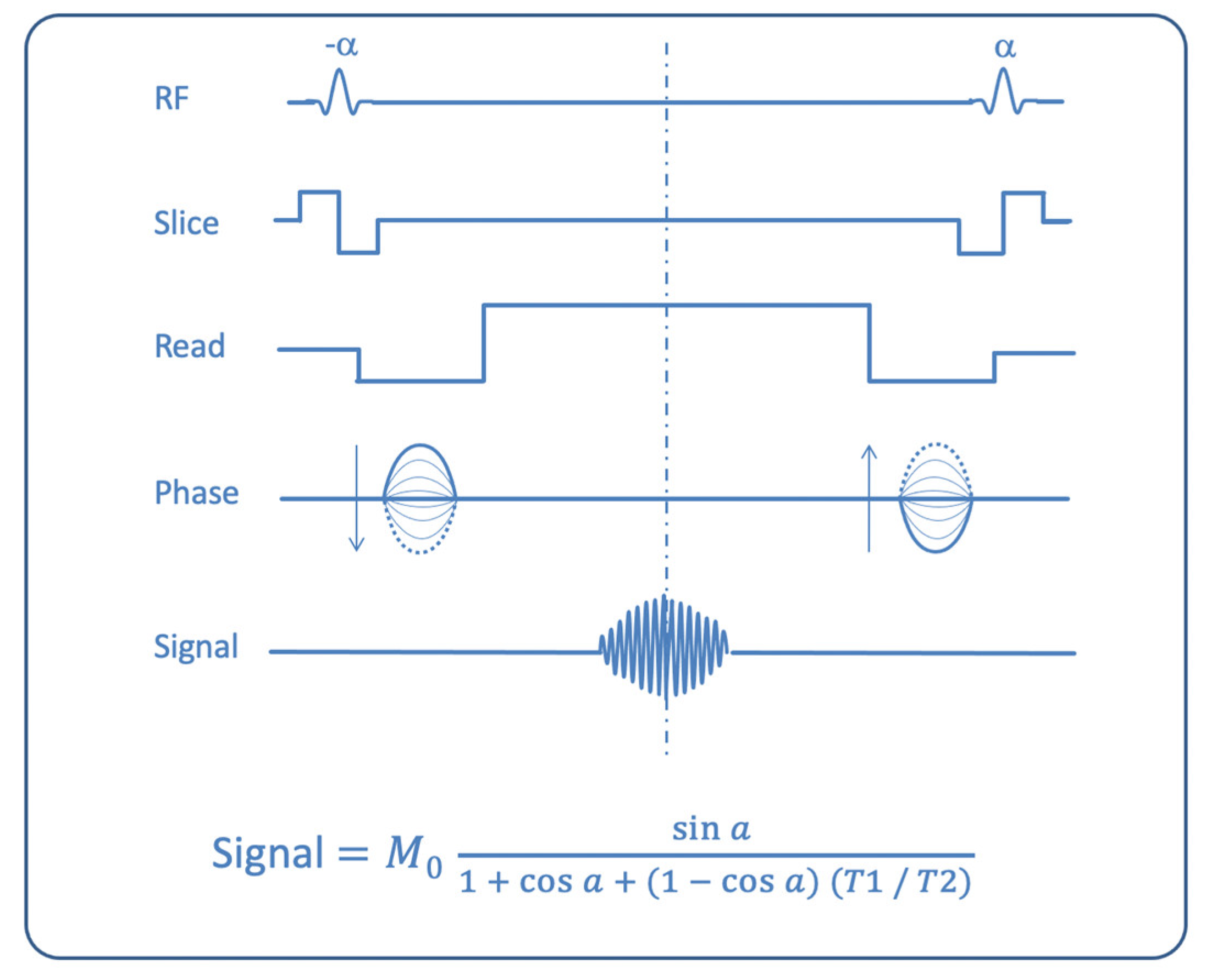 An example of non-contrast 3D turbo fi eld echo T1-weighted sequence of