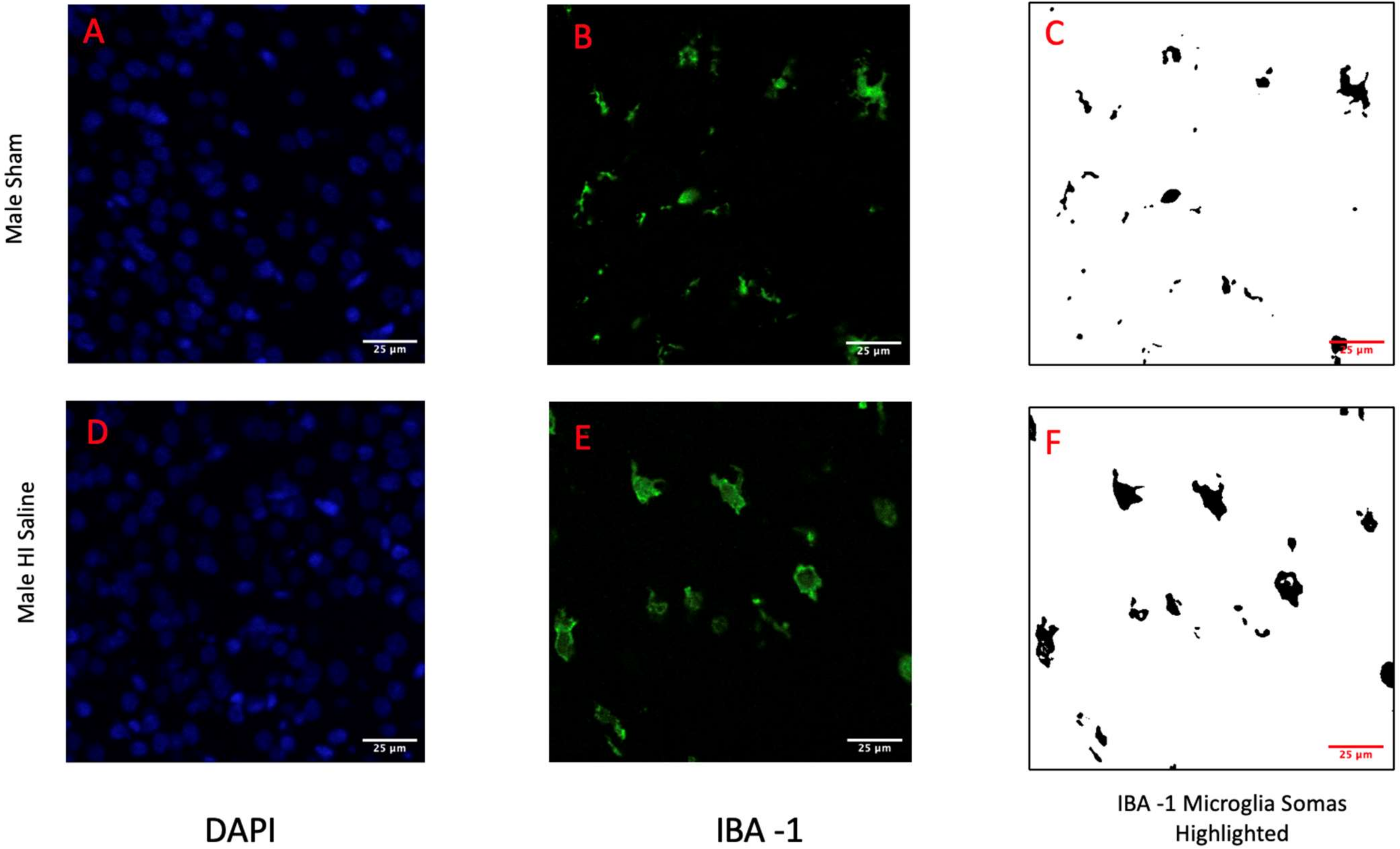 Biomedicines Free Full Text Sex Differences In Microglia Activation In A Rodent Model Of 5149