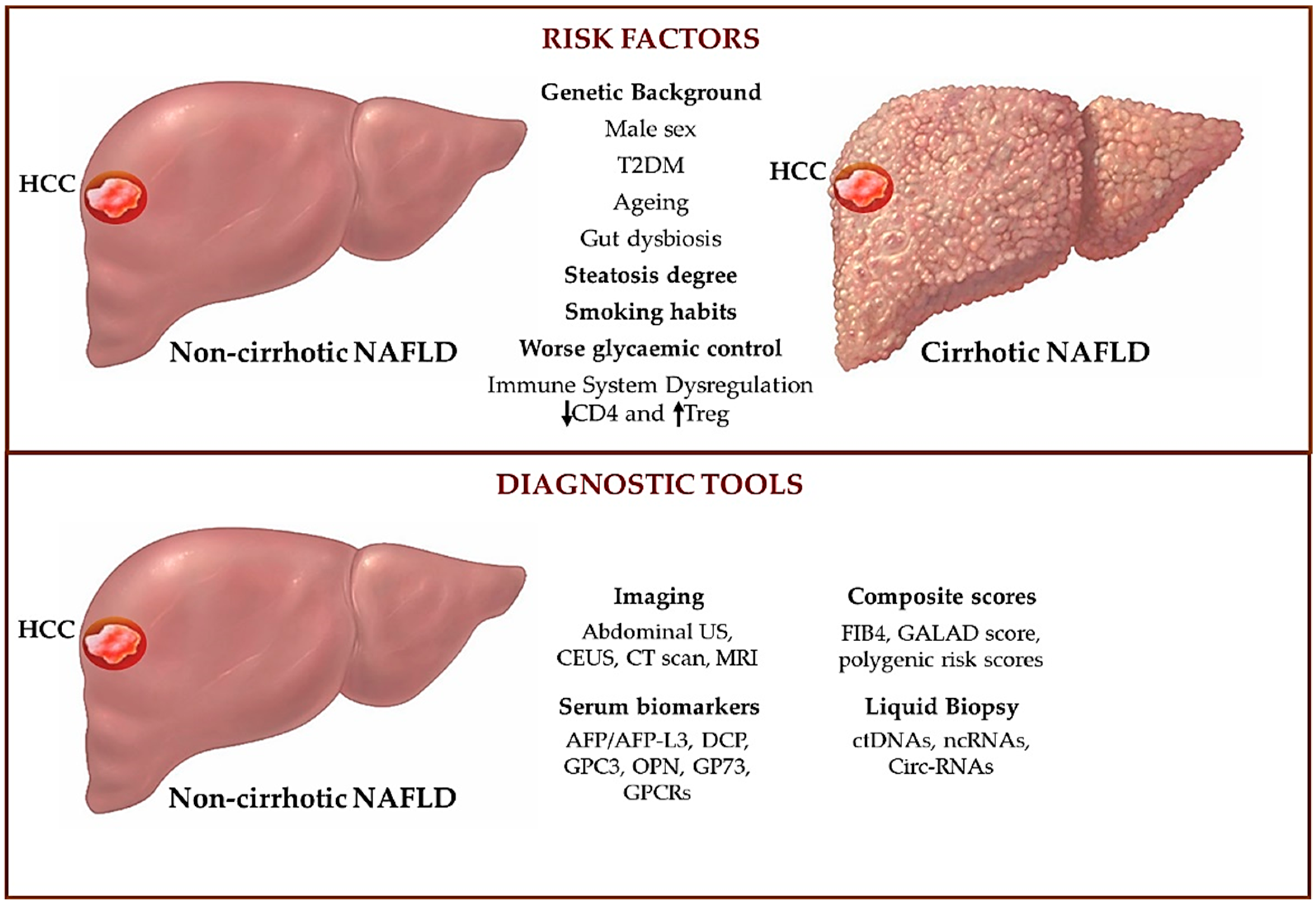 Biomedicines Free Full-Text An Overview of Hepatocellular Carcinoma Surveillance Focusing on Non-Cirrhotic NAFLD Patients A Challenge for Physicians