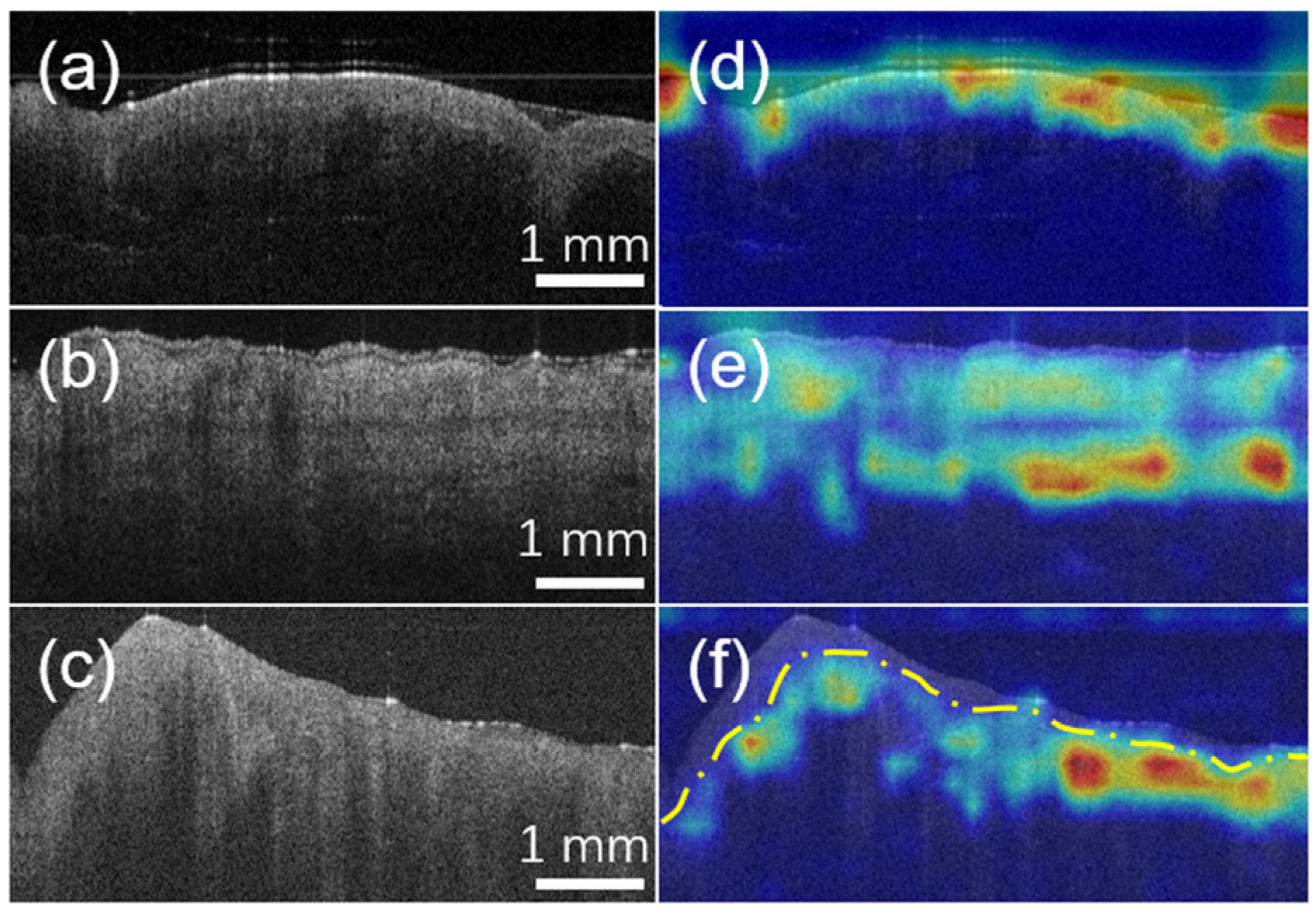 biomedicines-free-full-text-deep-learning-based-automated